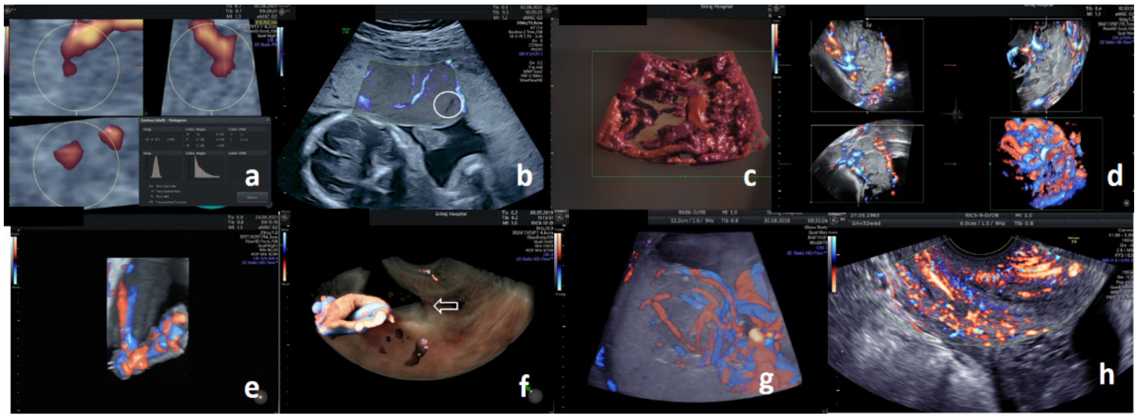 Diagnostics 11 01511 g002