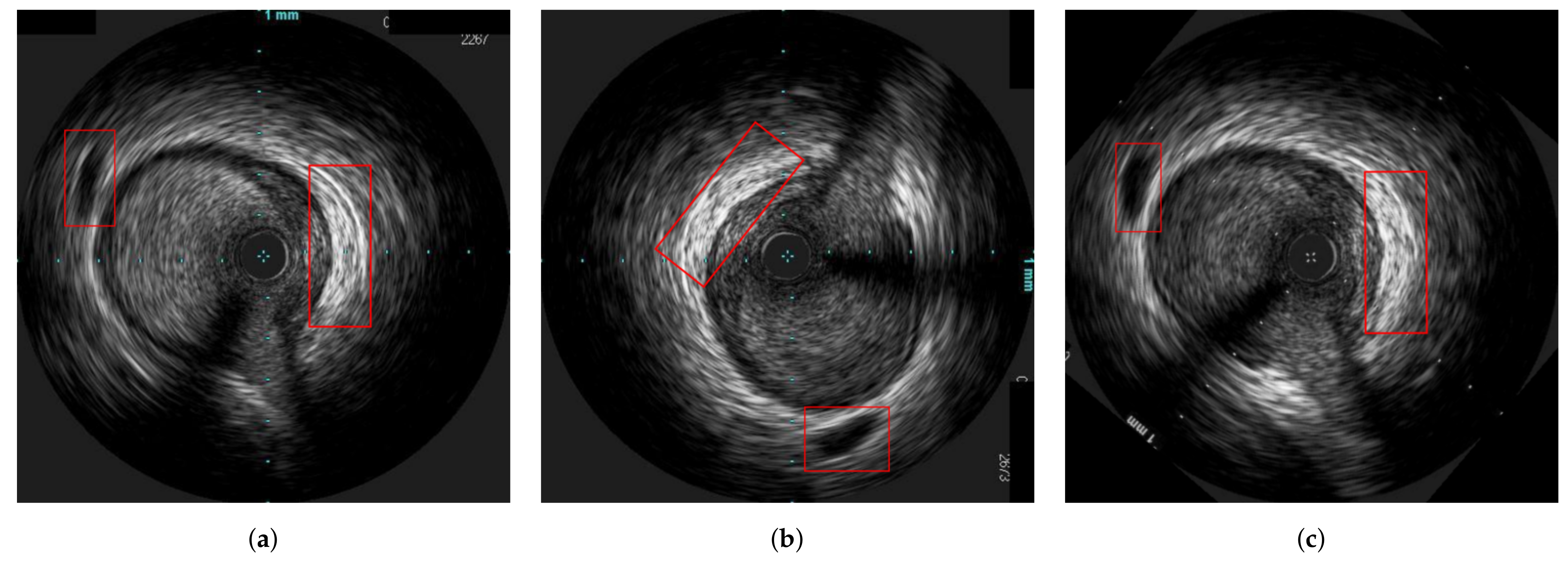 Diagnostics 11 01513 g011