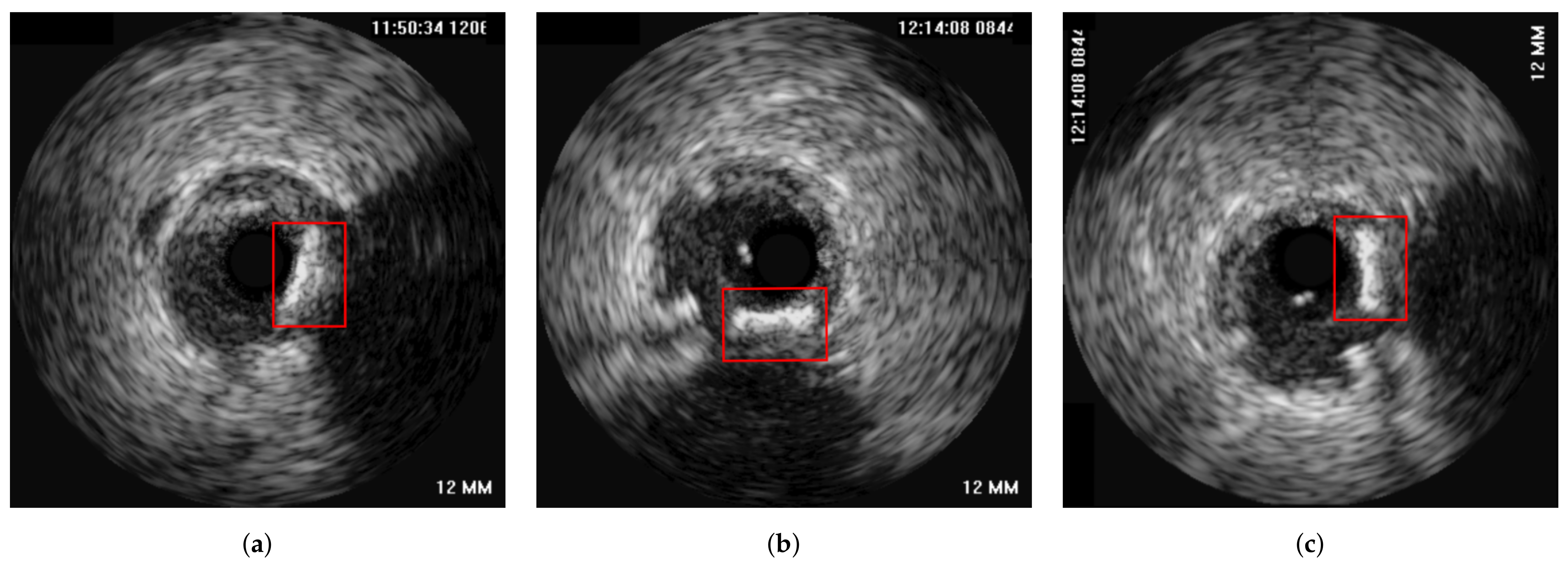 Diagnostics 11 01513 g012