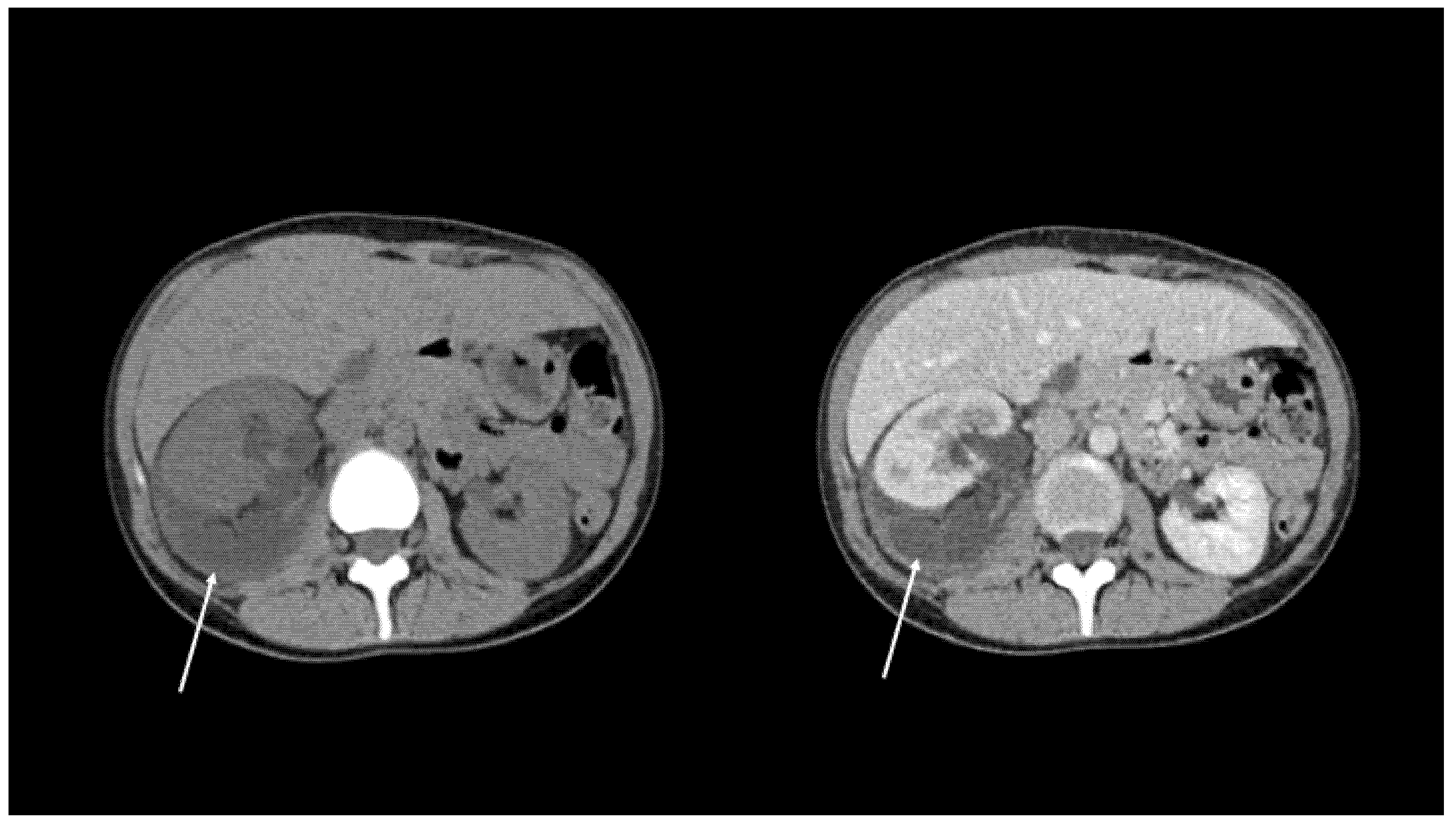 Diagnostics 11 01568 g003 Diagnostics 11 01568 g003