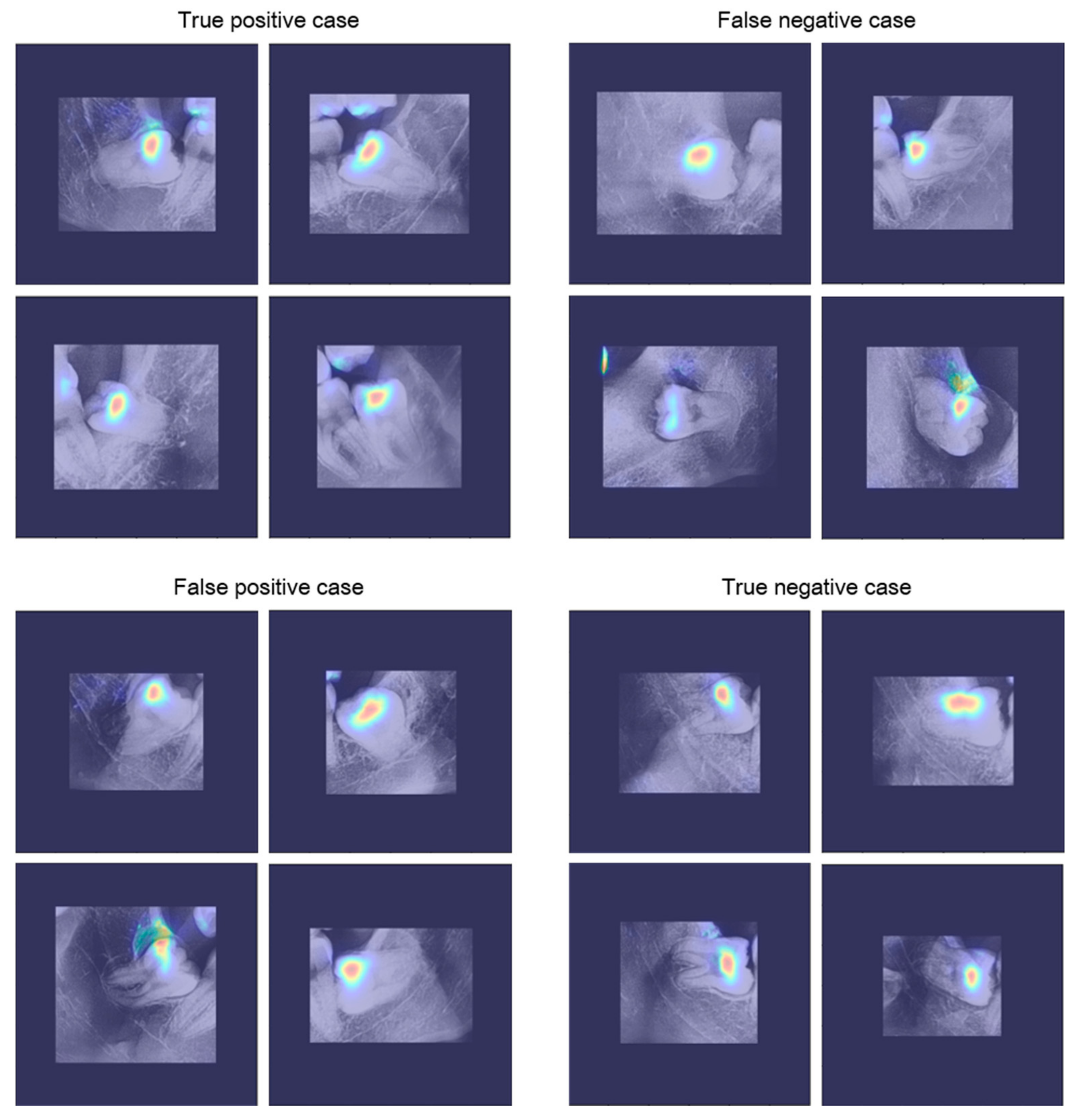 Diagnostics 11 01572 g007 550