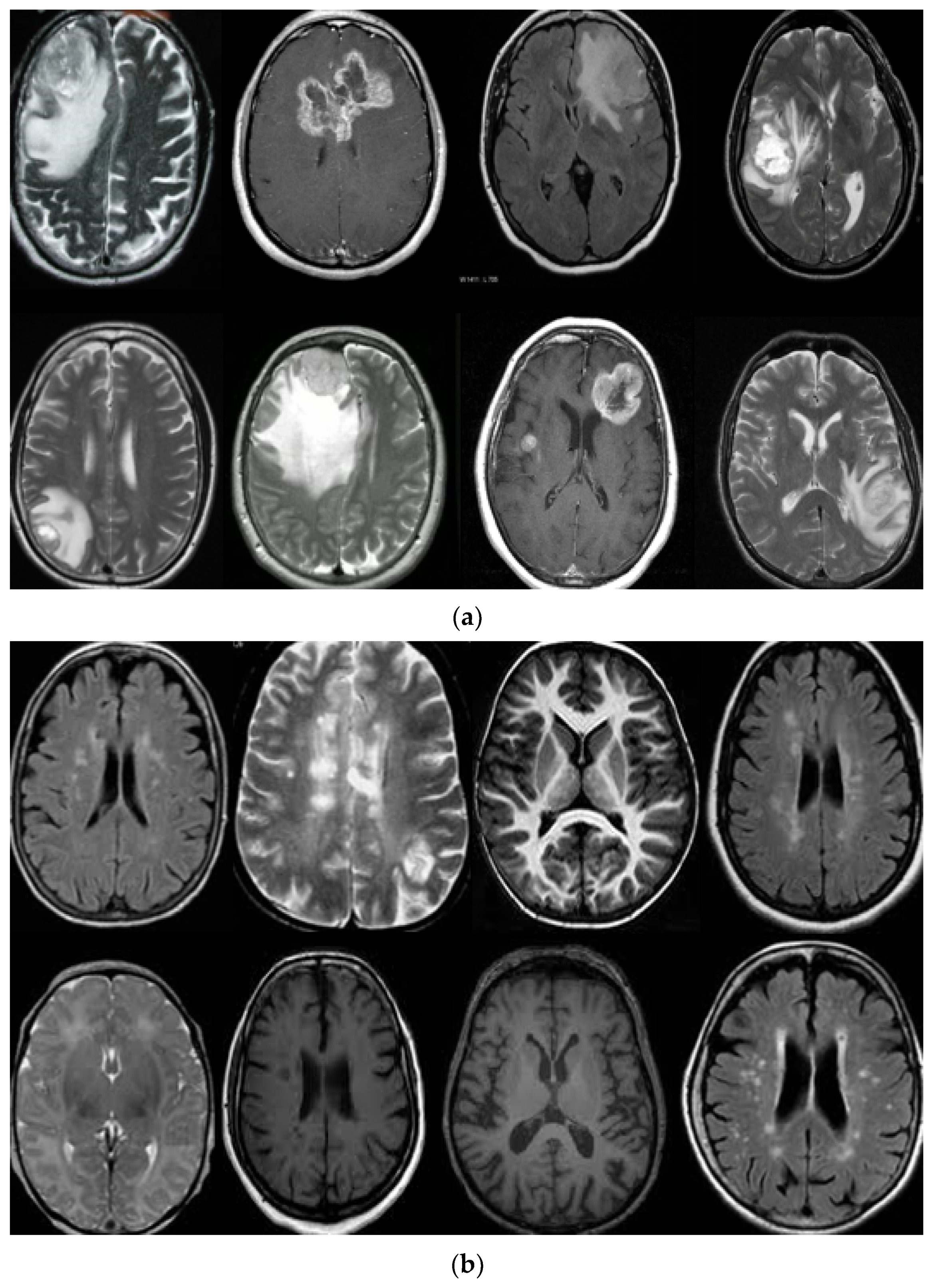 PDF) Epilepsy and the Laboratory Technician: Technique in Histology and  Fiction