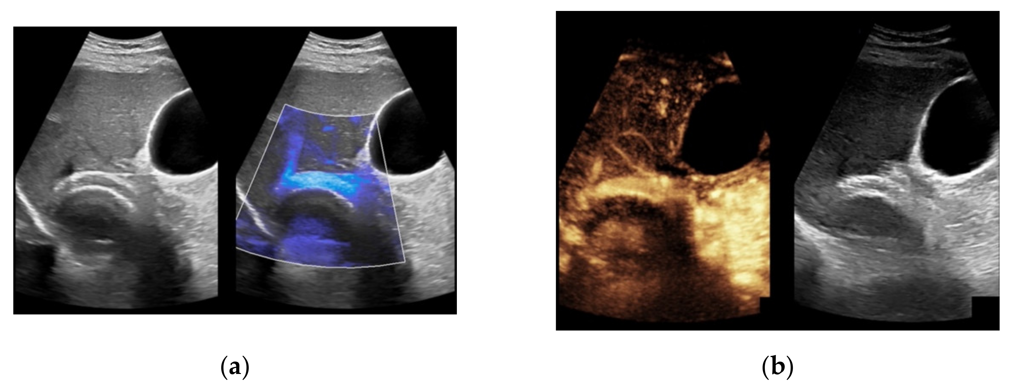 Diagnostics 11 01593 g004a