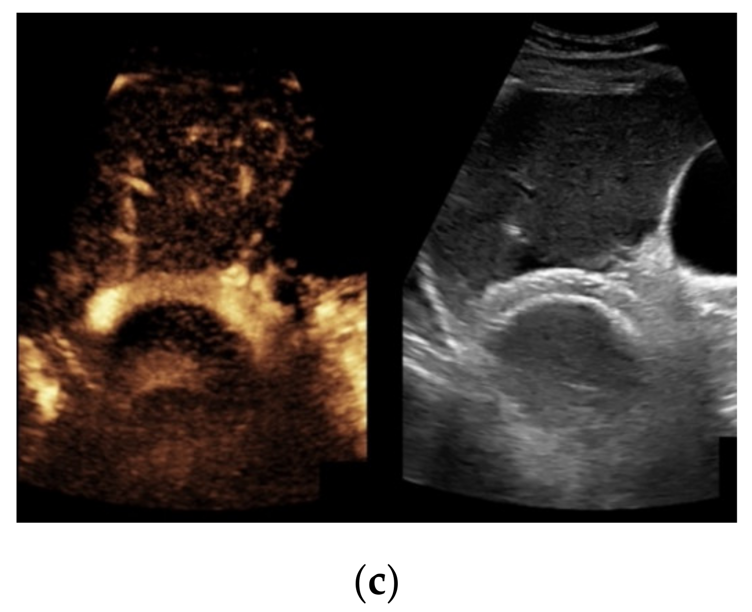 Diagnostics 11 01593 g004b
