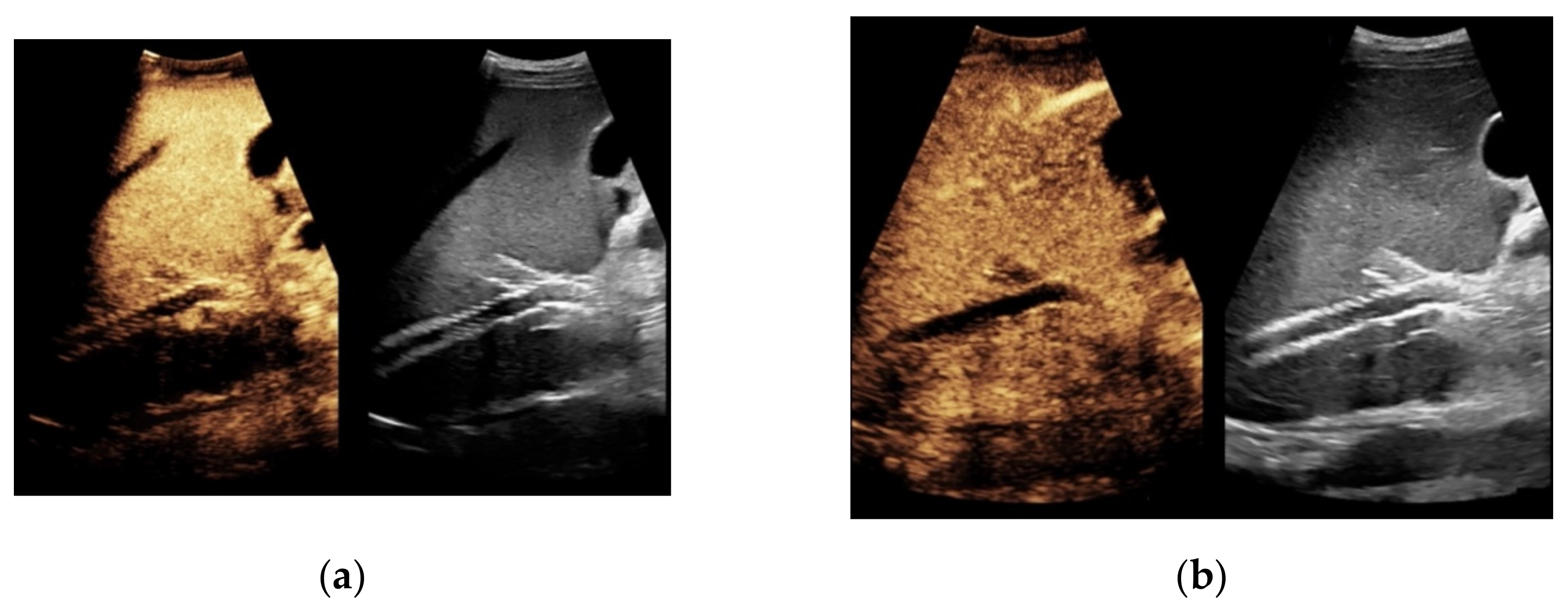 Diagnostics 11 01593 g005