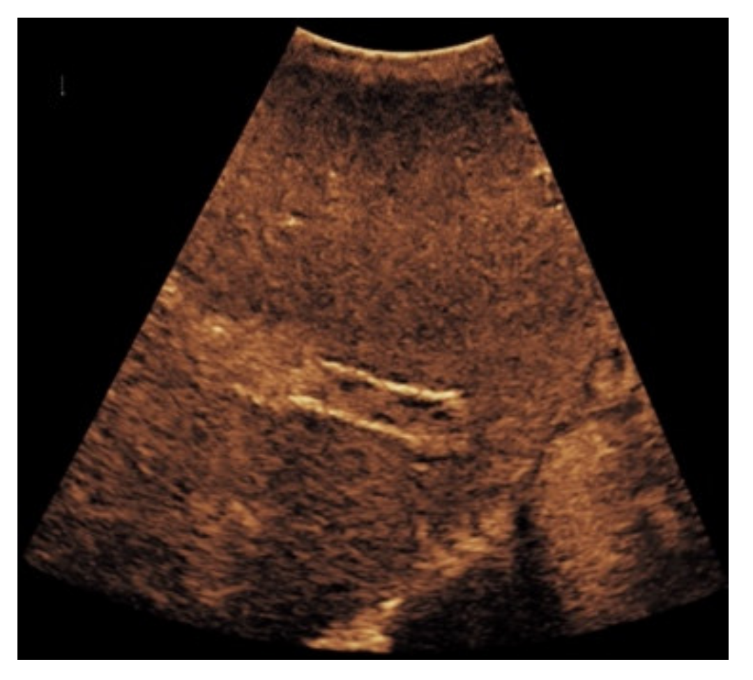 Diagnostics 11 01593 g006