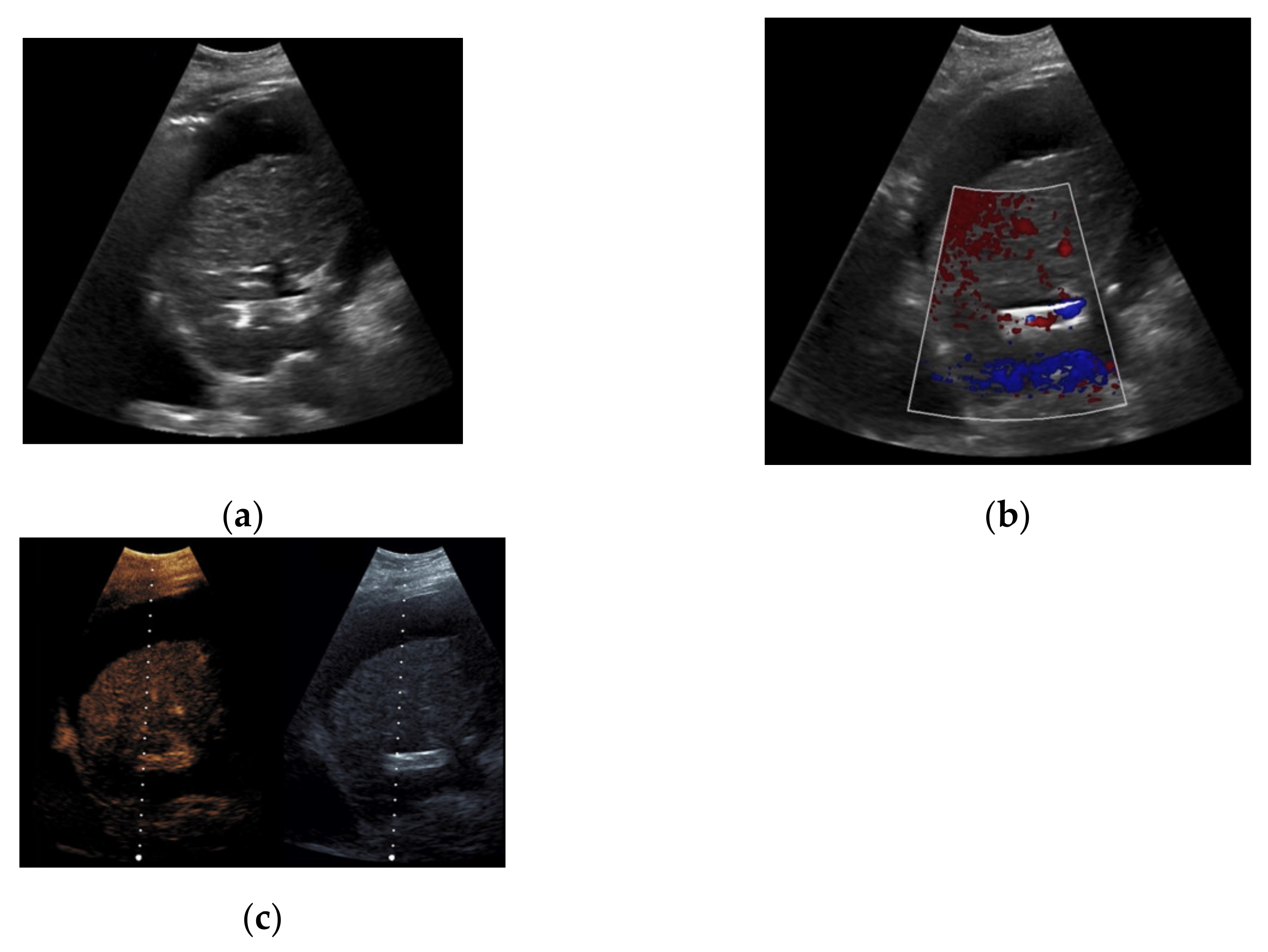 Diagnostics 11 01593 g007