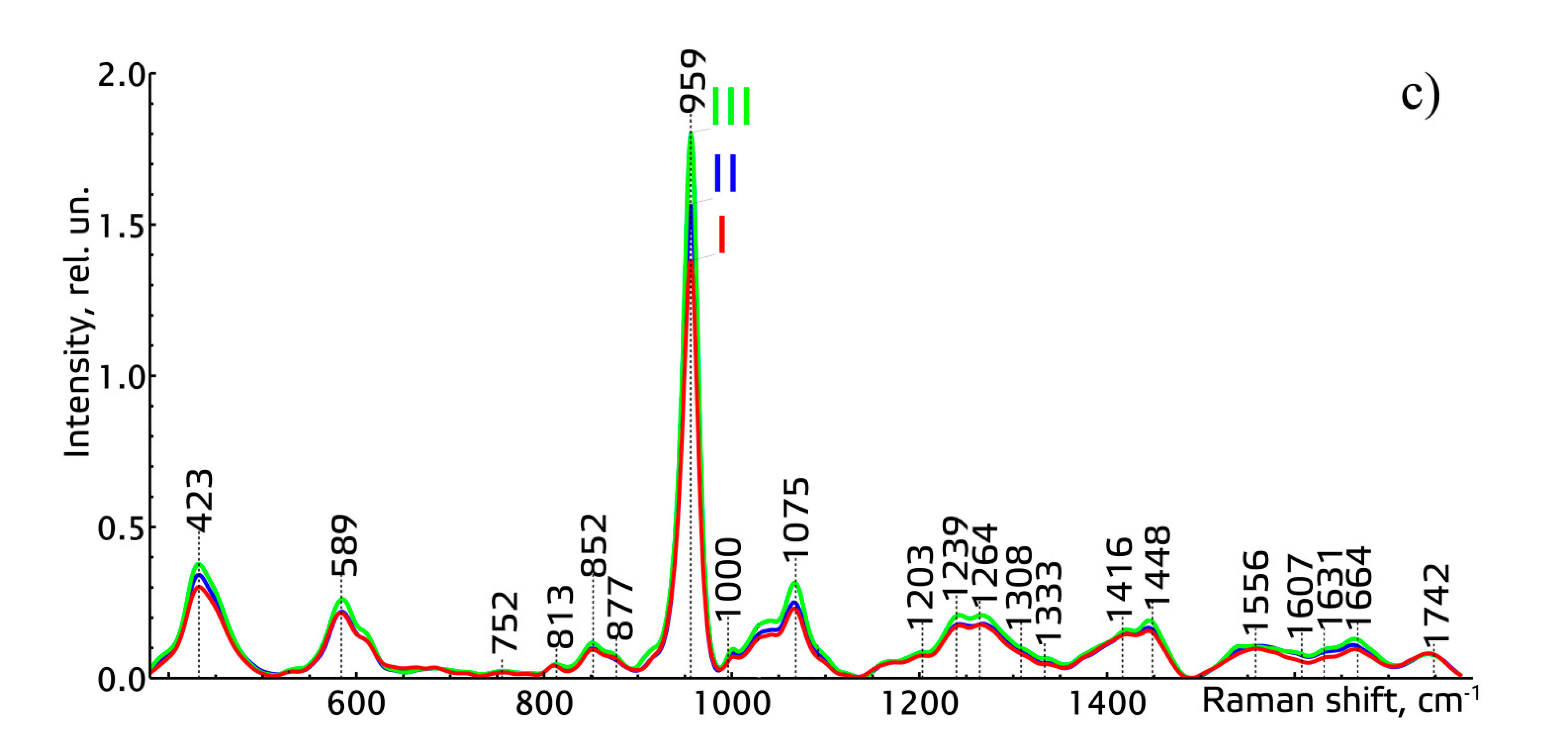 Diagnostics Free FullText Raman Spectroscopy for Assessment of