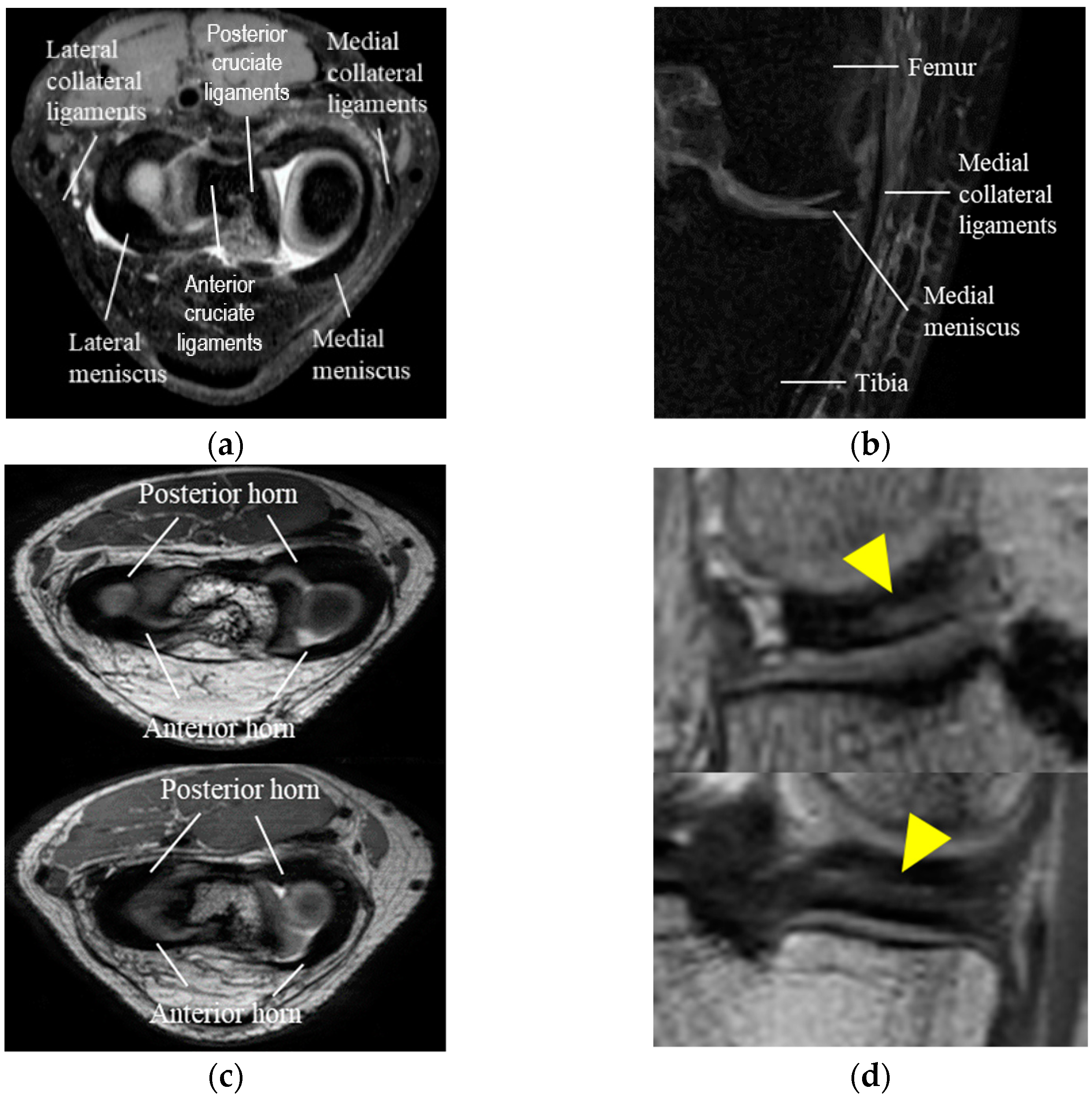 Diagnostics 11 01612 g001 550