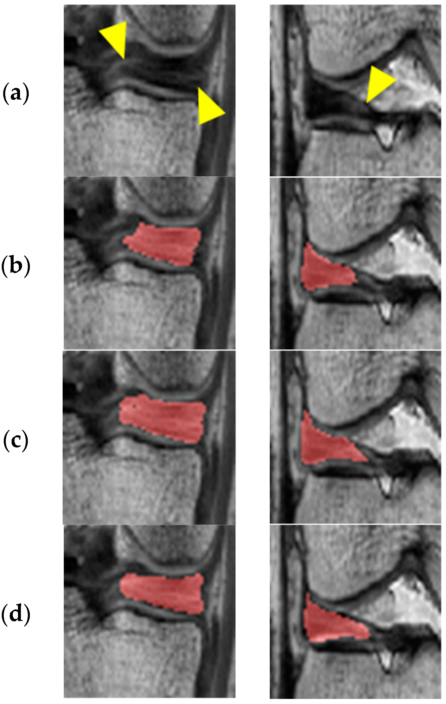Diagnostics 11 01612 g005 550