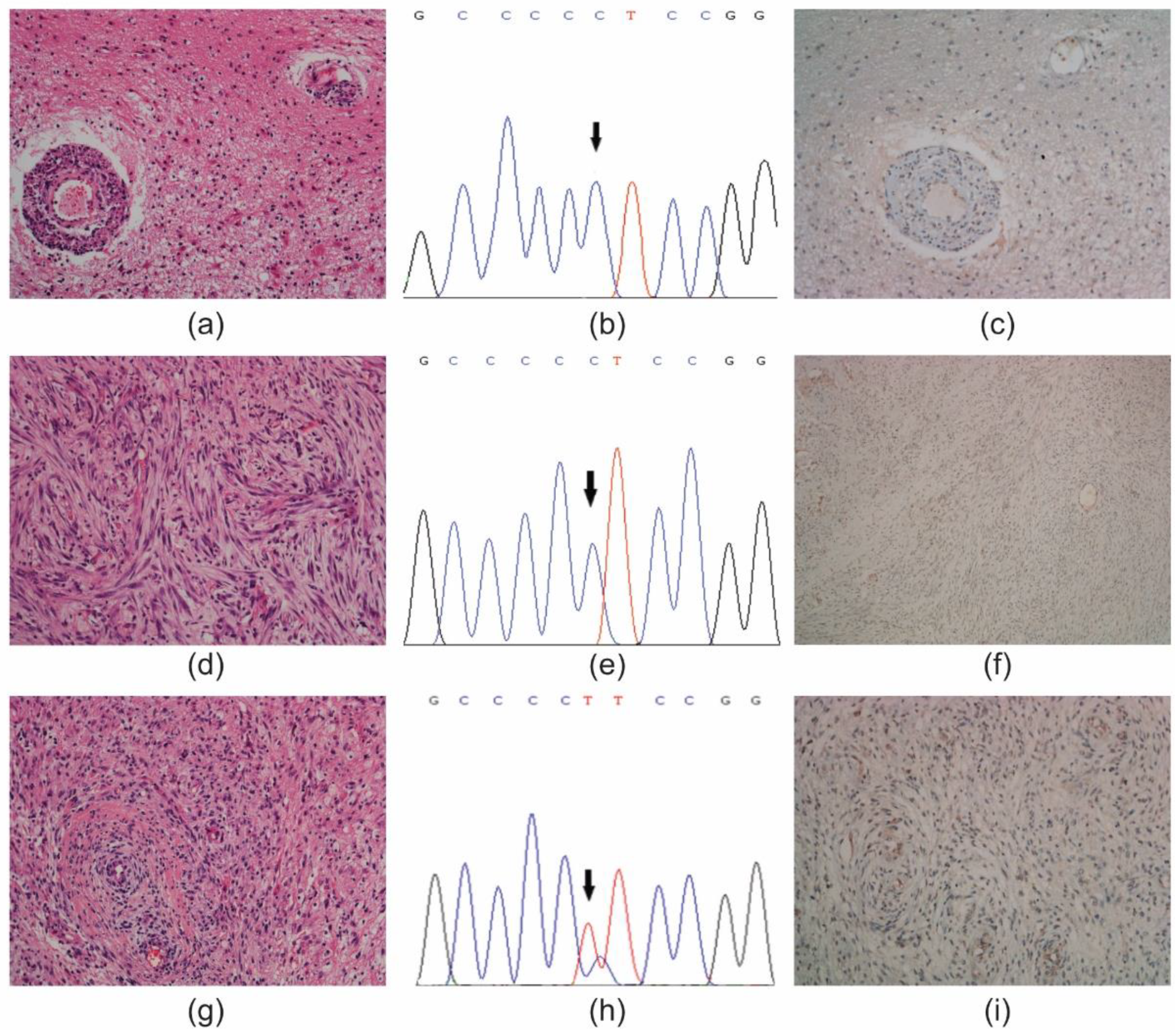 Diagnostics 11 01624 g002 550