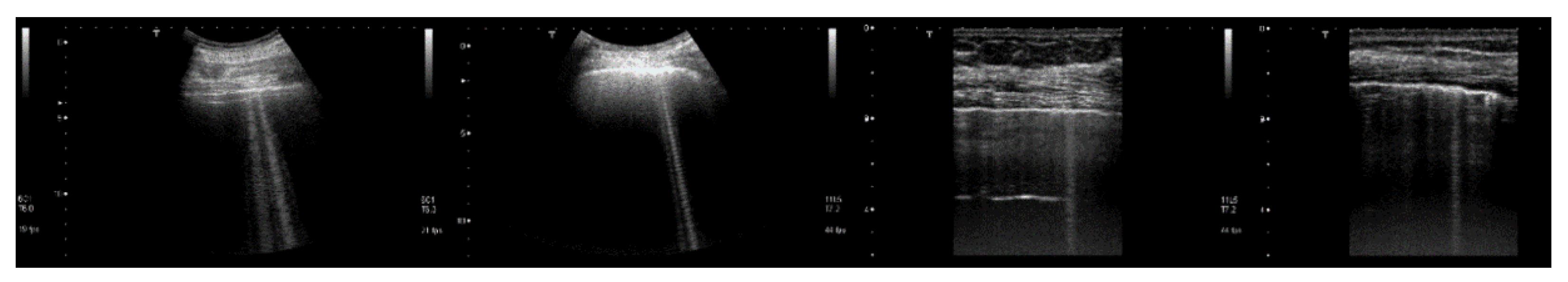 Diagnostics 11 01666 g009