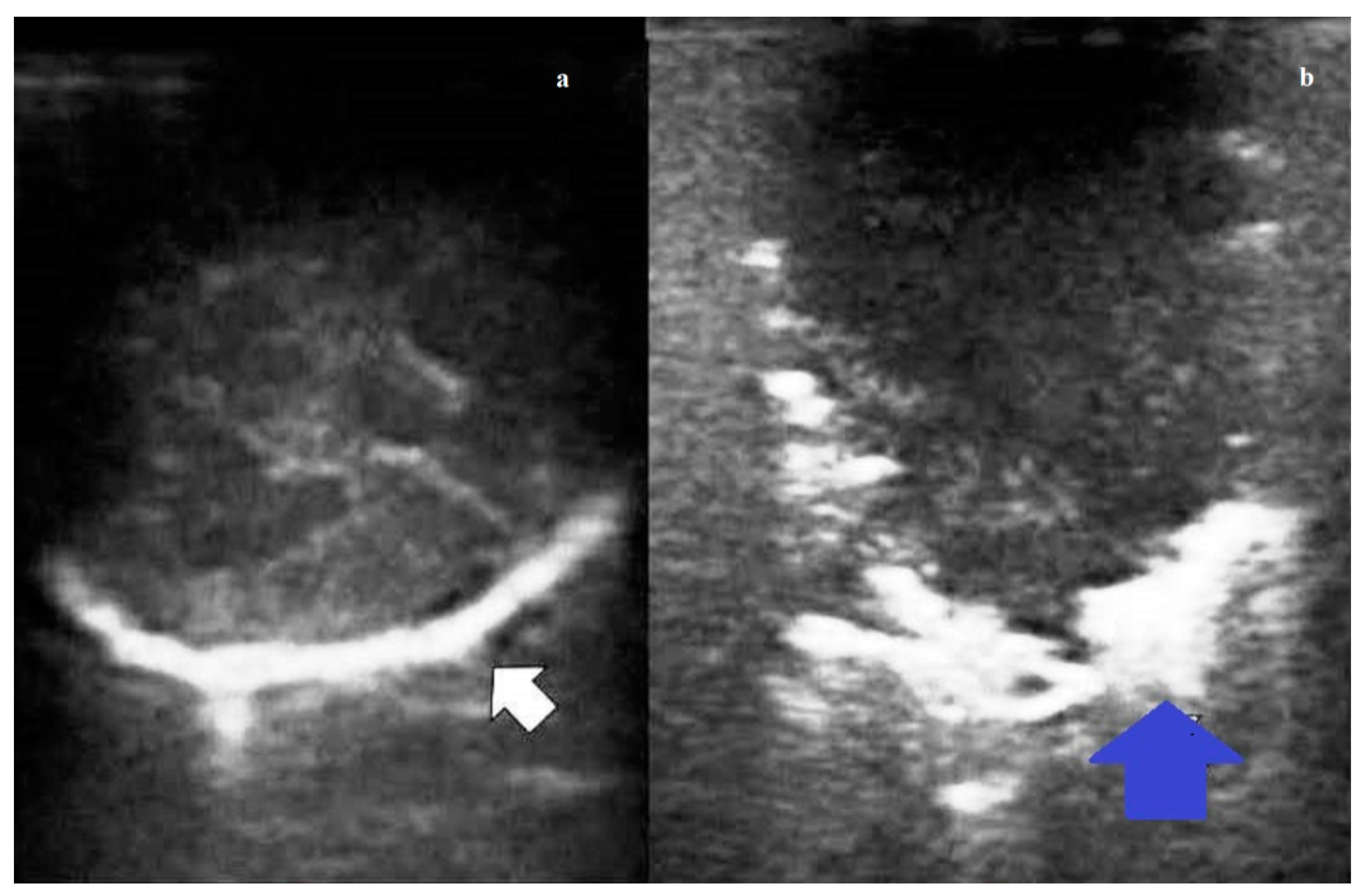 Diagnostics 11 01691 g002 550