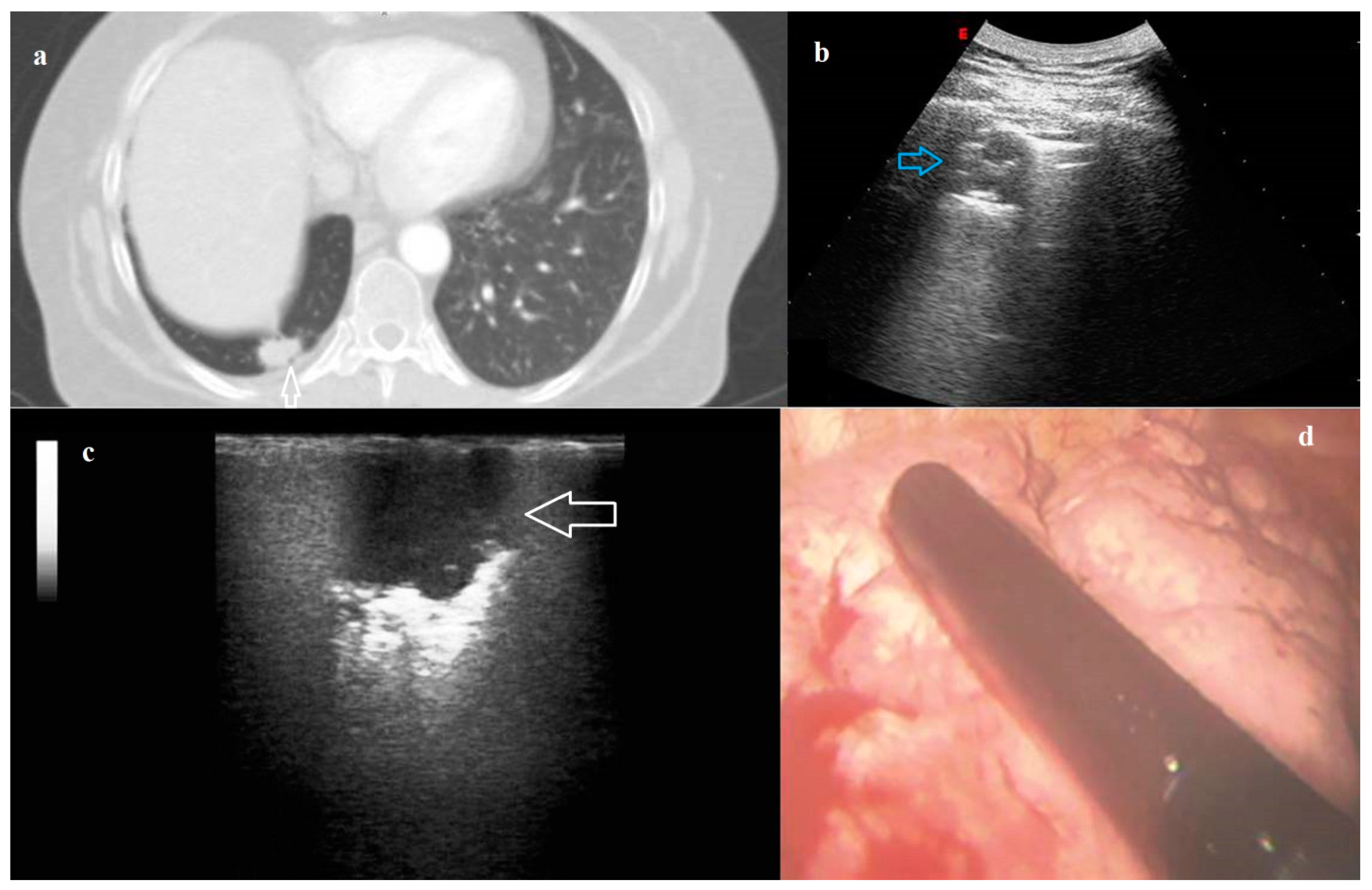 Diagnostics 11 01691 g003 550