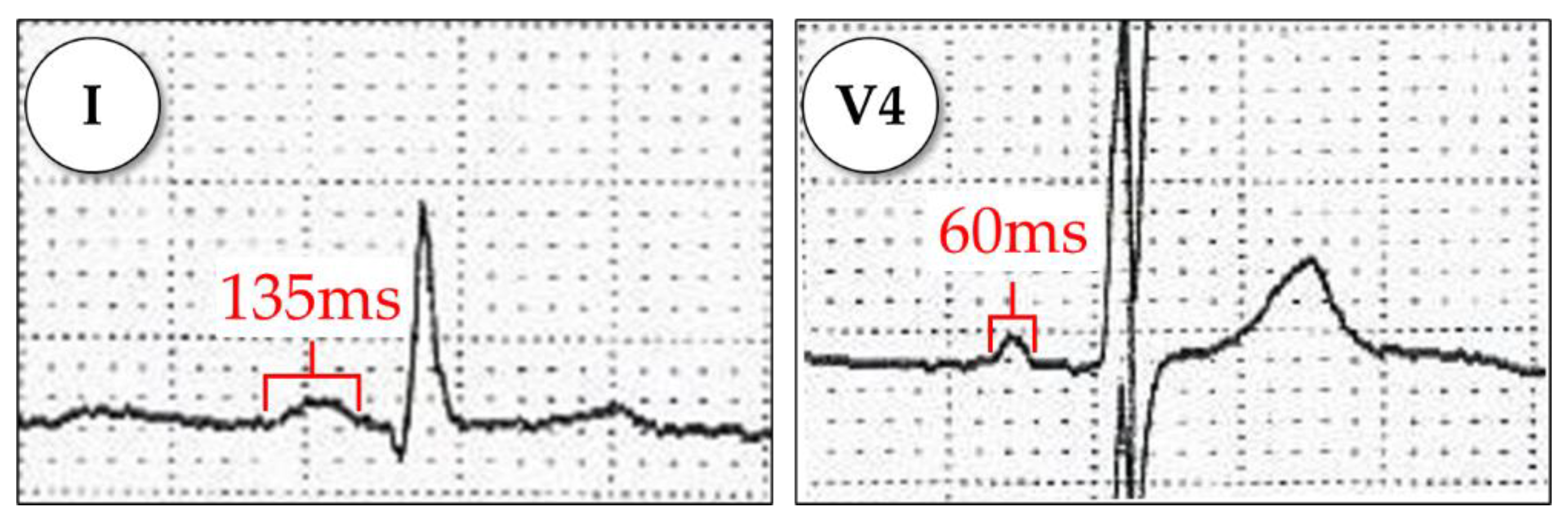 Diagnostics 11 01694 g0a2