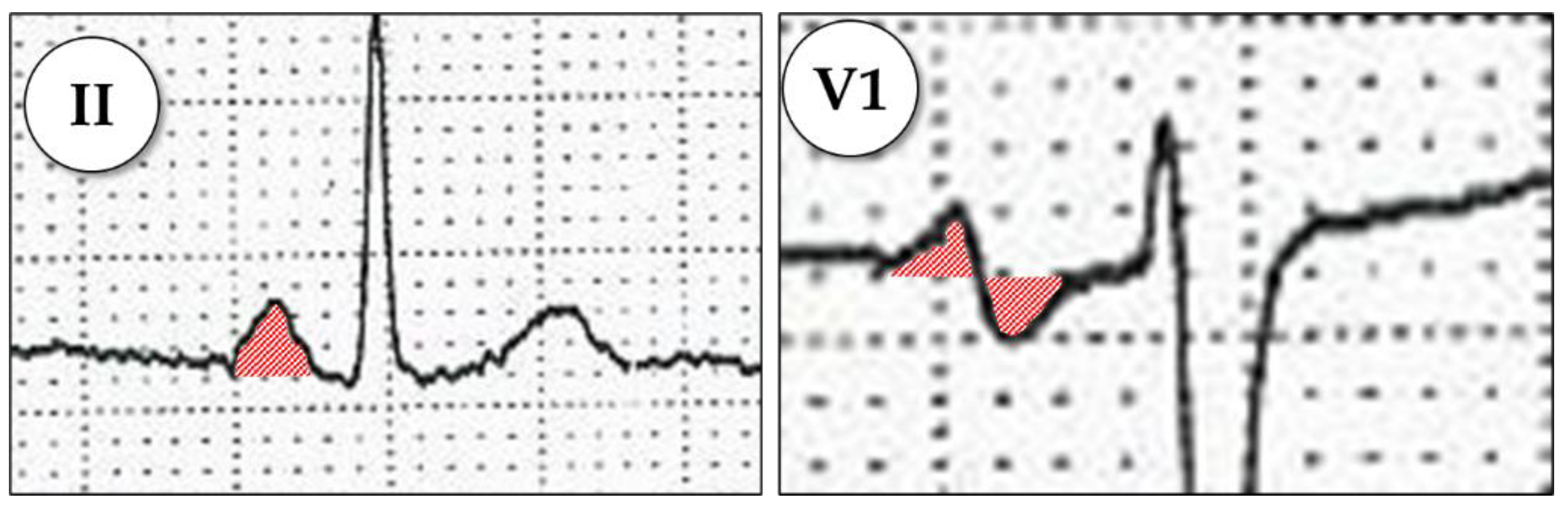 Diagnostics 11 01694 g0a3