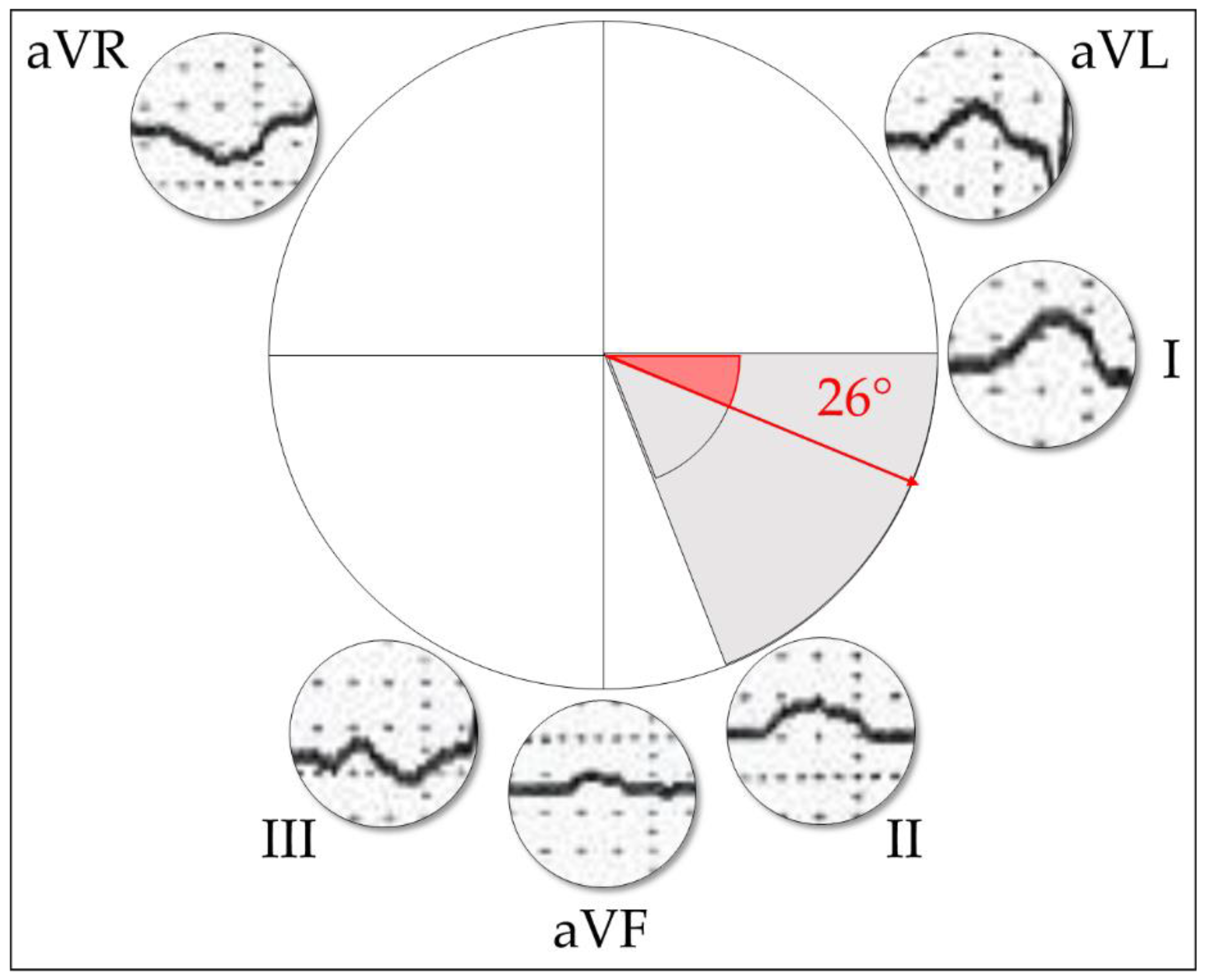 Diagnostics 11 01694 g0a5