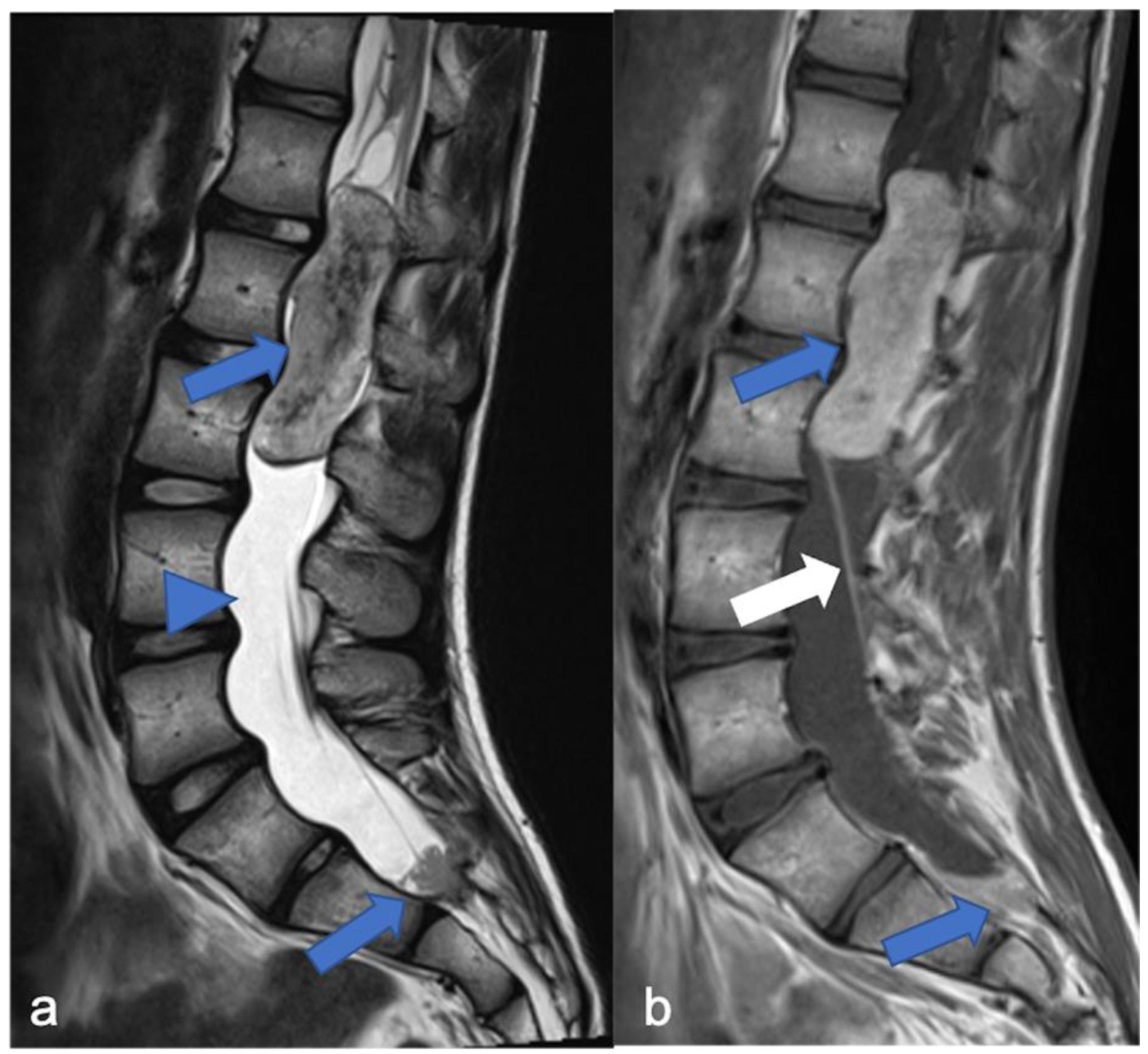 Diagnostics 11 01710 g008 Diagnostics 11 01710 g008