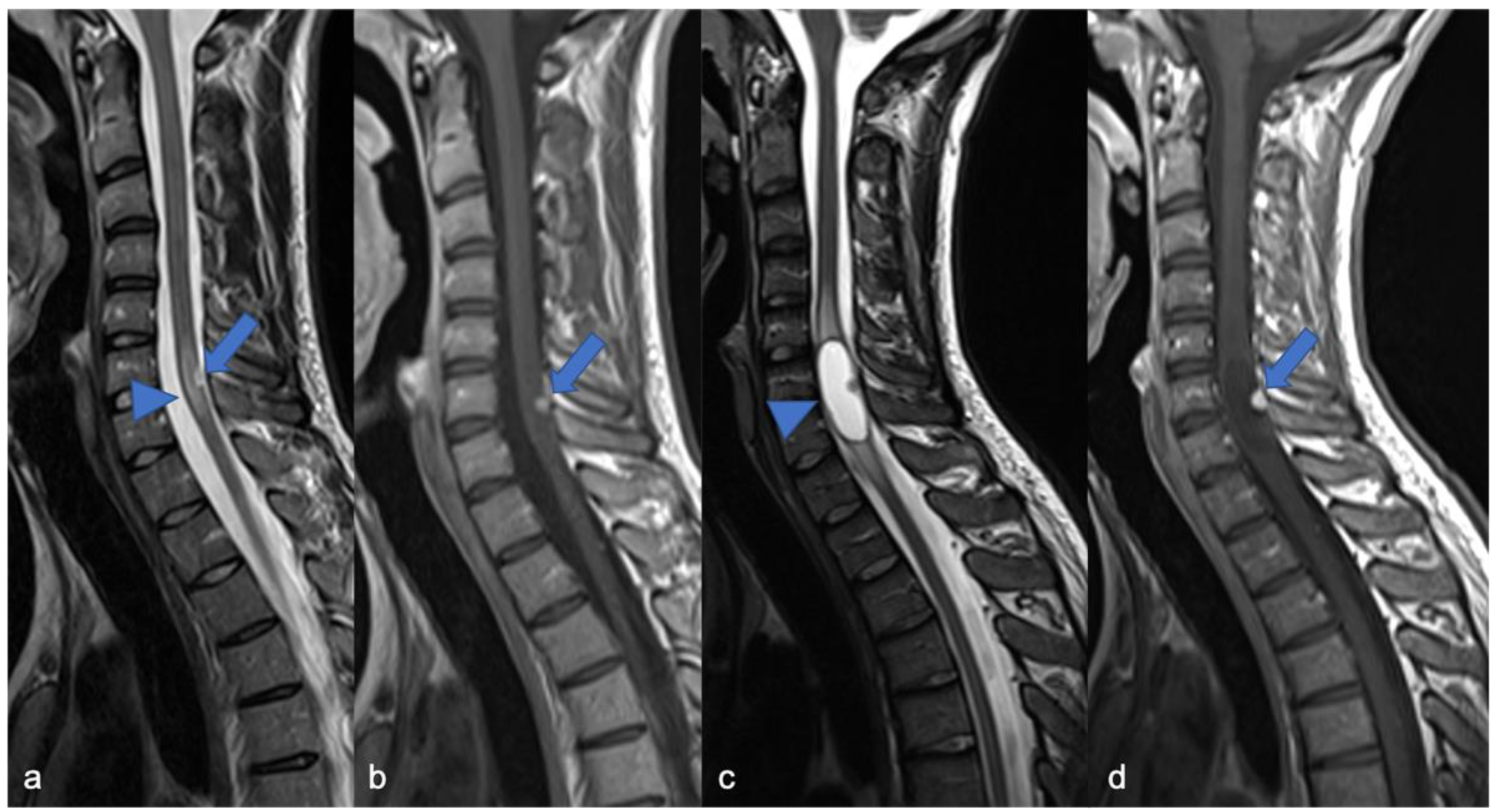 Diagnostics 11 01710 g009 Diagnostics 11 01710 g009