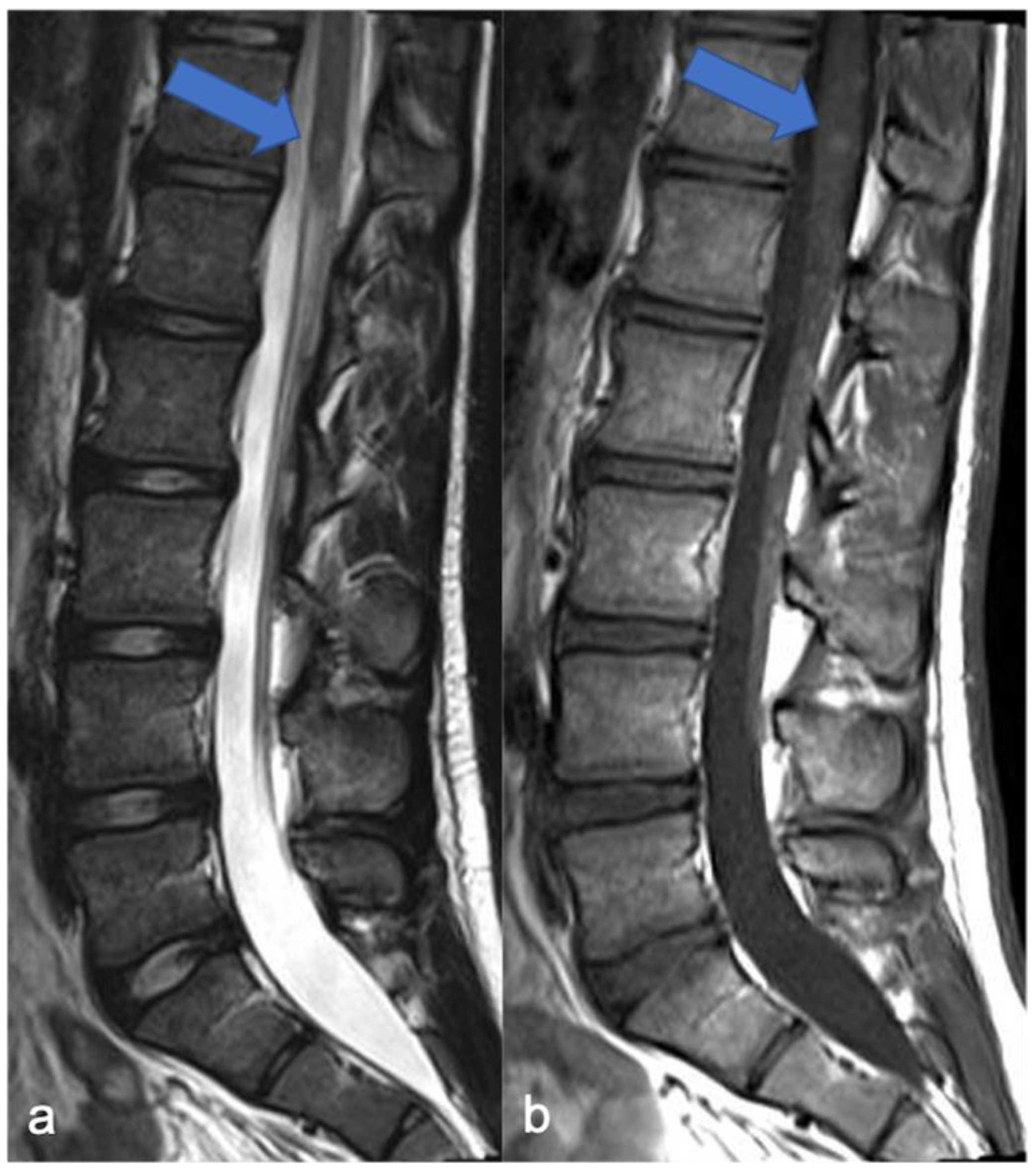 Diagnostics 11 01710 g012 Diagnostics 11 01710 g012