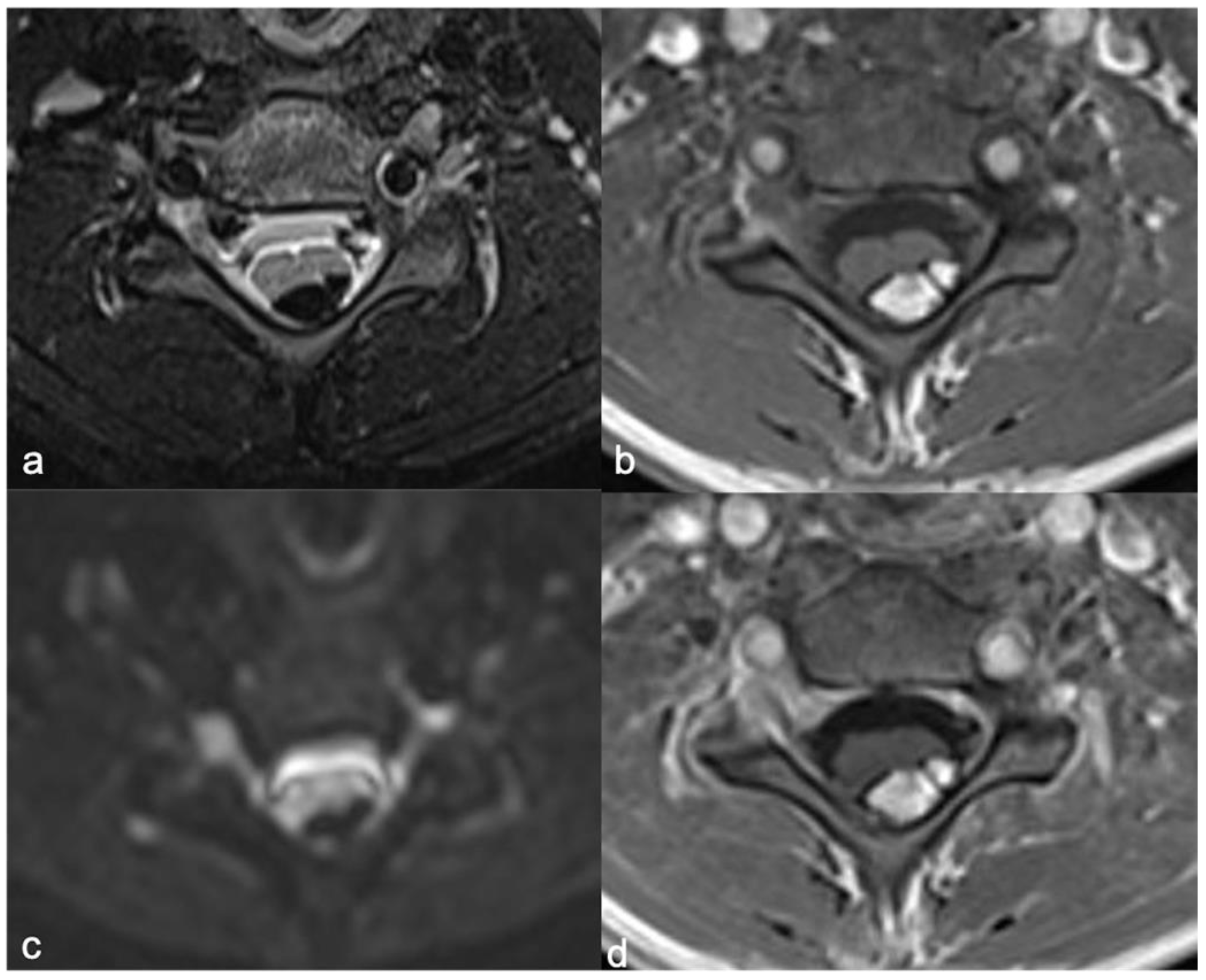Diagnostics 11 01710 g016 Diagnostics 11 01710 g016