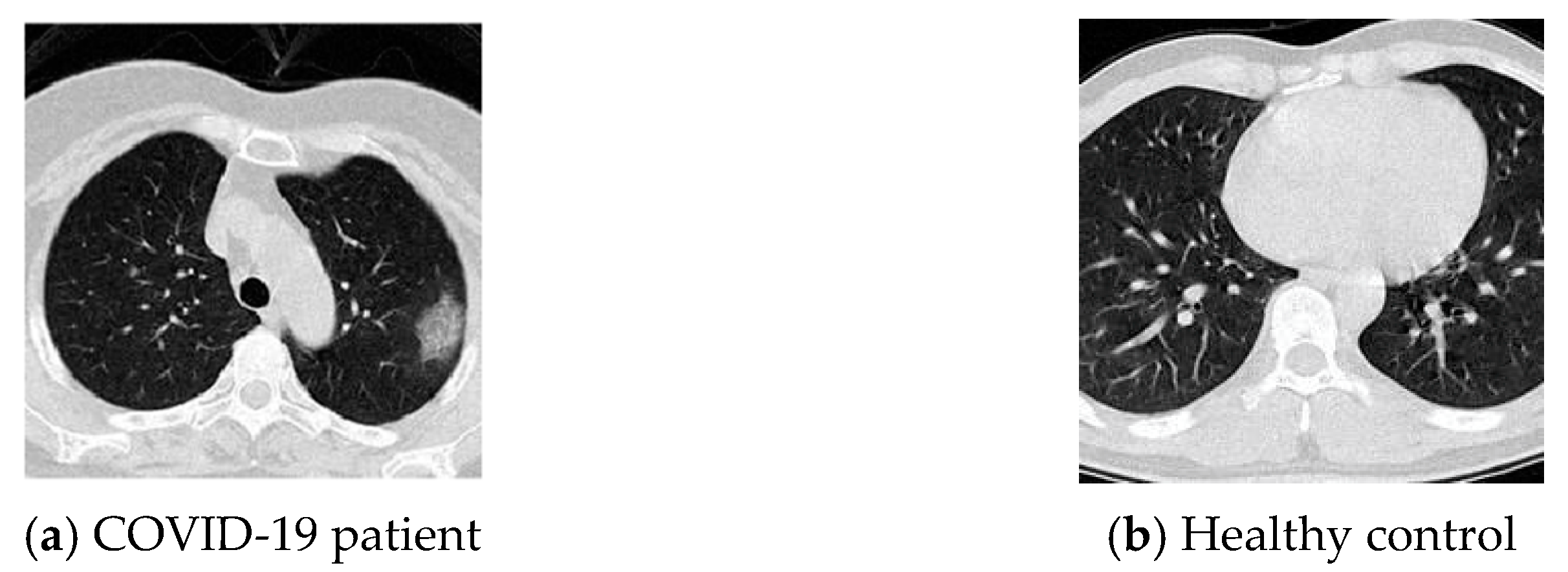 Diagnostics 11 01712 g002 550