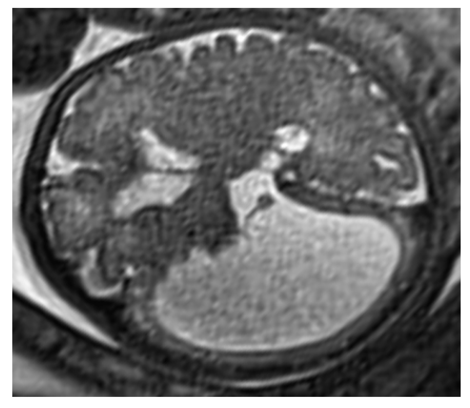 Diagnostics 11 01723 g002