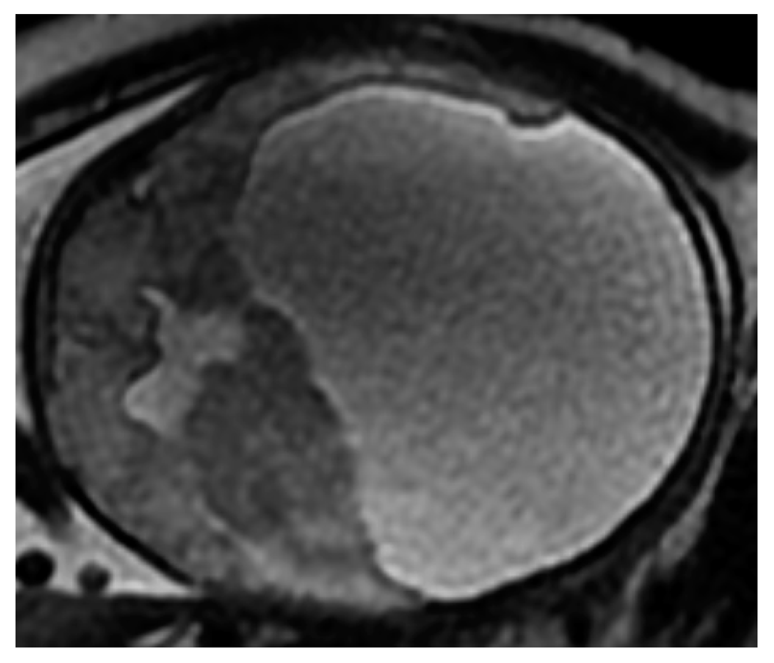 Diagnostics 11 01723 g006