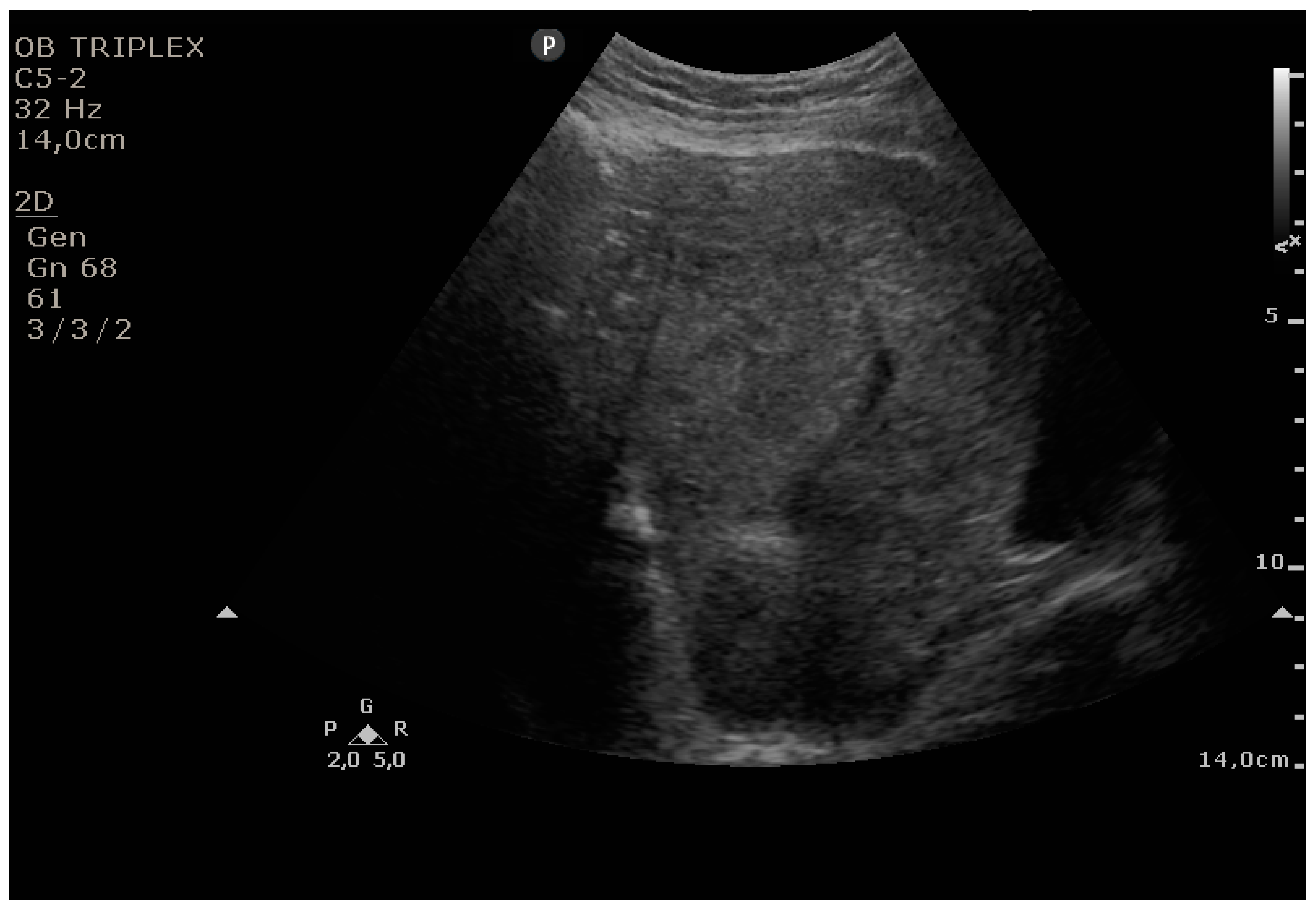 Diagnostics 11 01731 g004 550