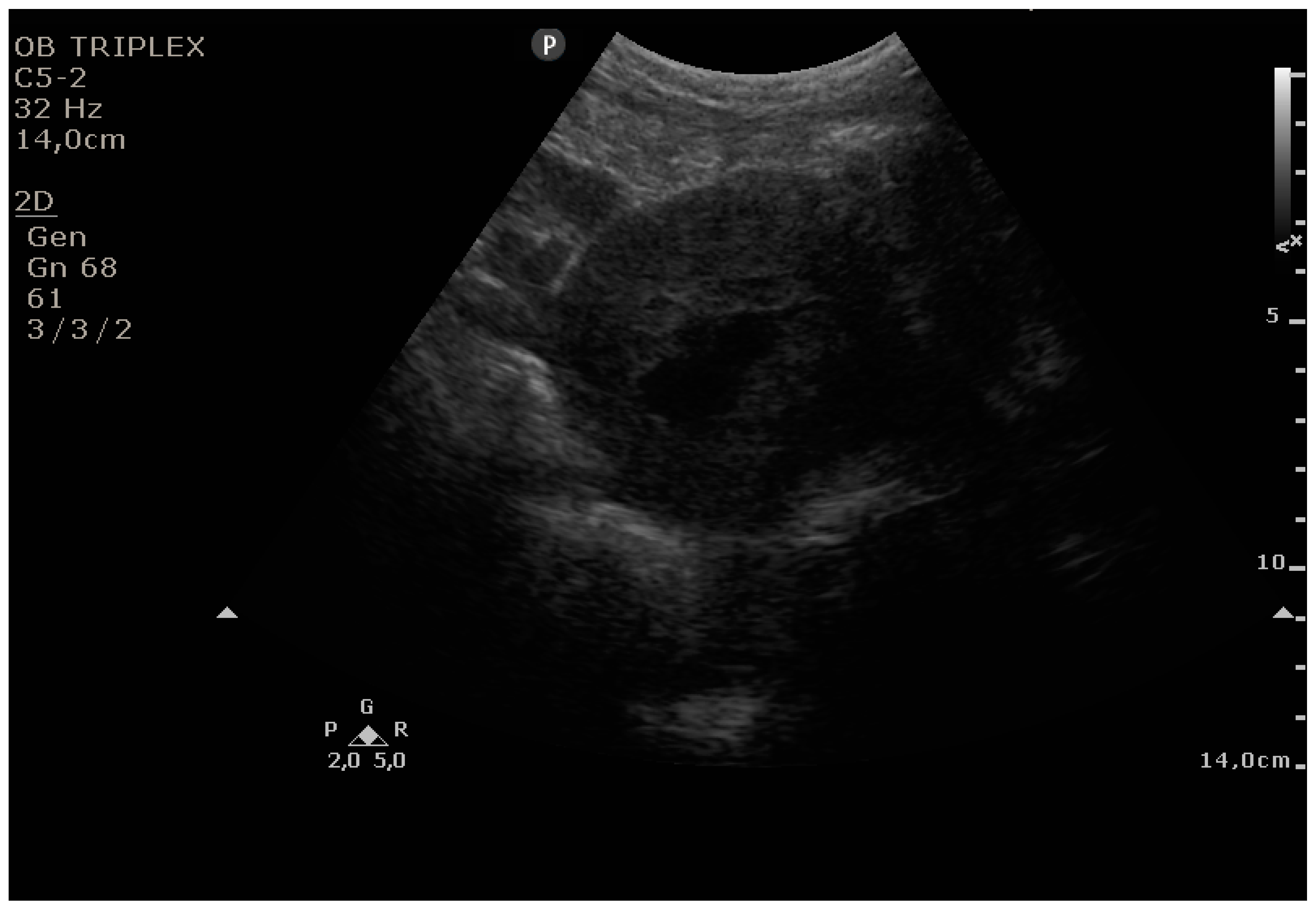 Diagnostics 11 01731 g005 550