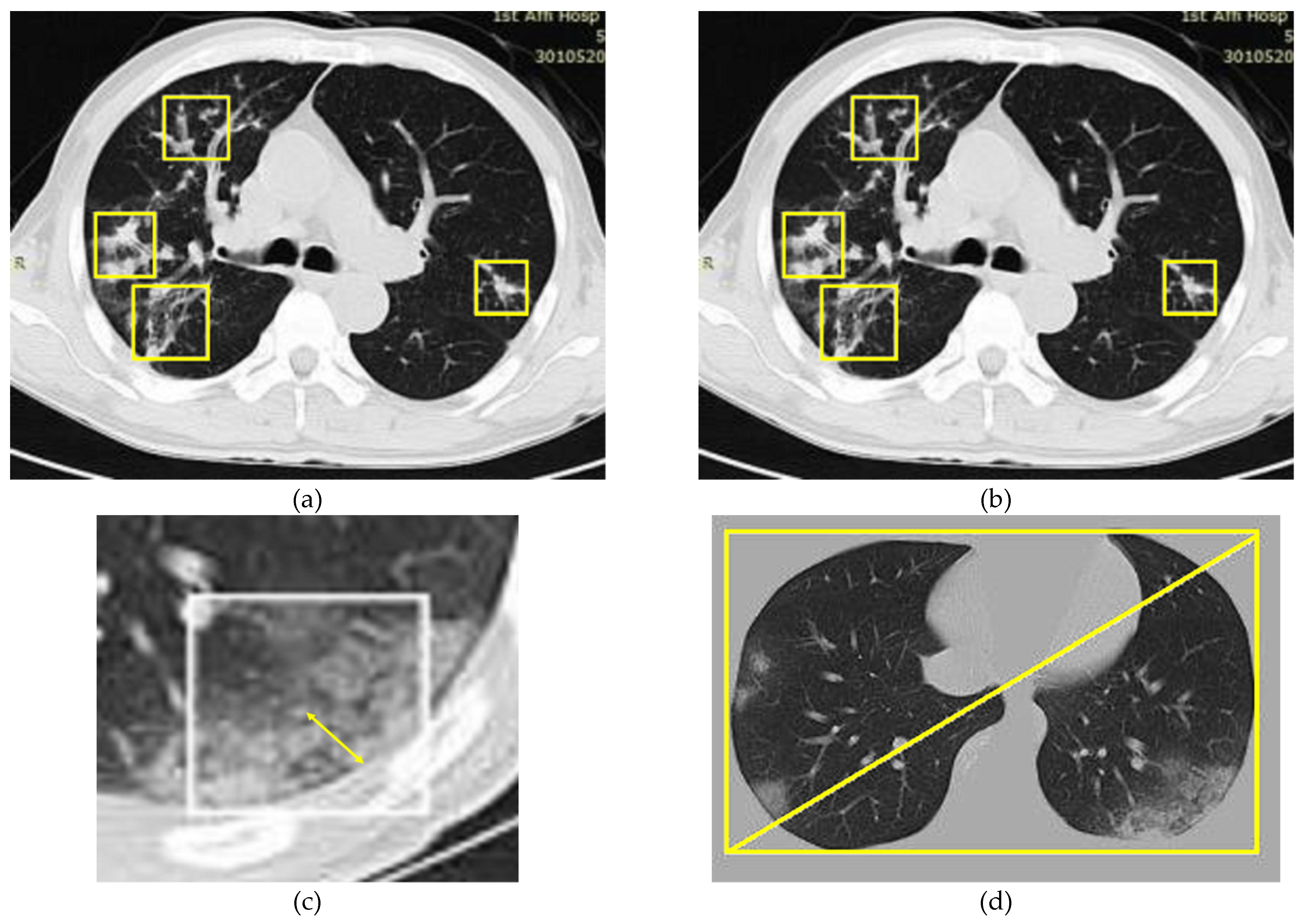 Diagnostics 11 01735 g004
