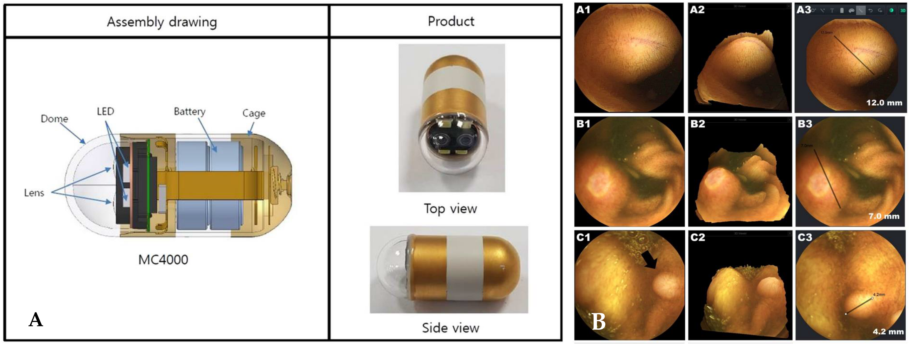 Diagnostics Free FullText Capsule Endoscopy Pitfalls and