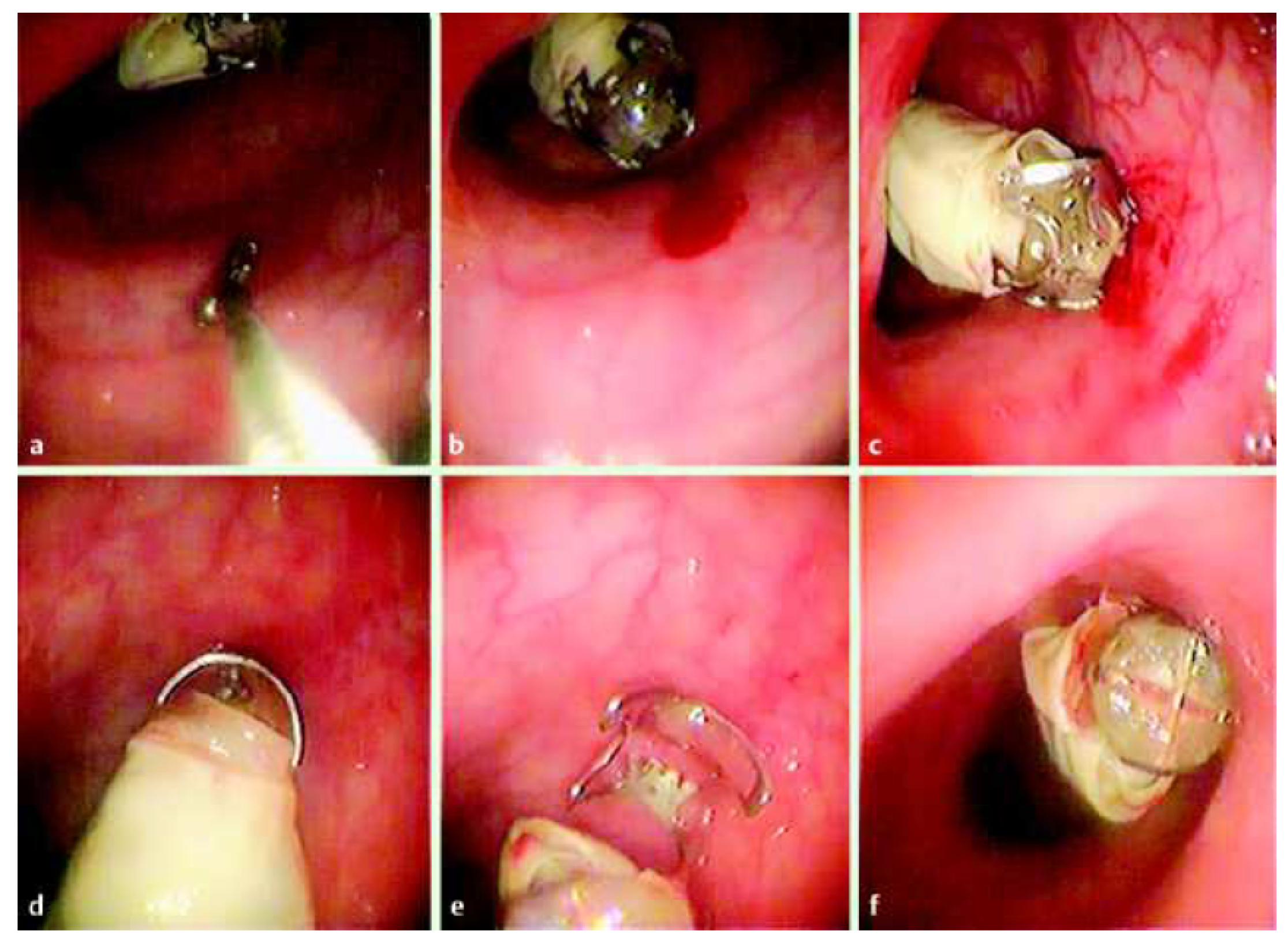 Diagnostics 11 01765 g011