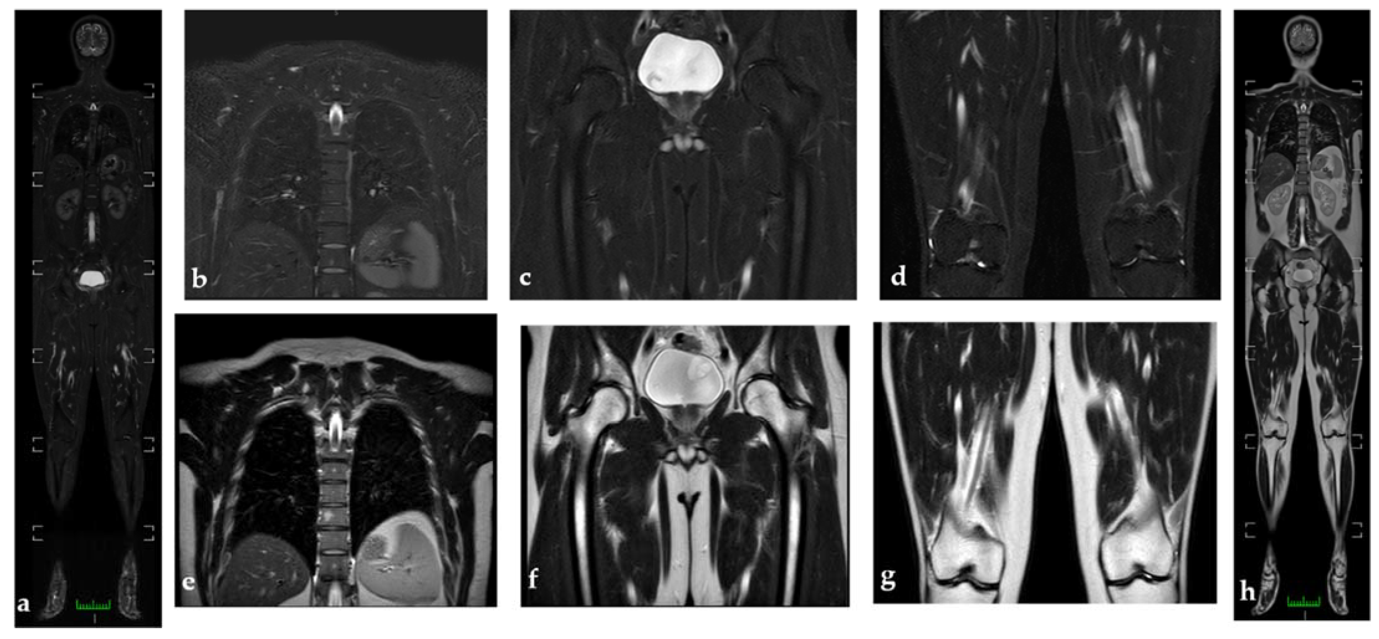 Diagnostics 11 01770 g002