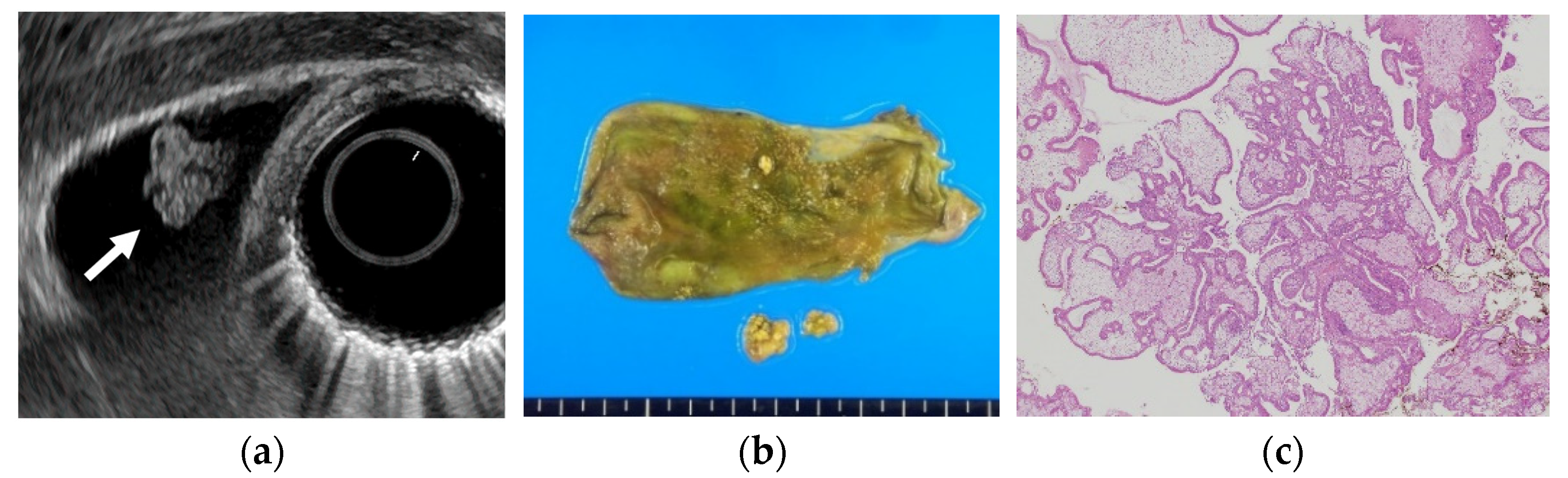 Diagnostics 11 01789 g001