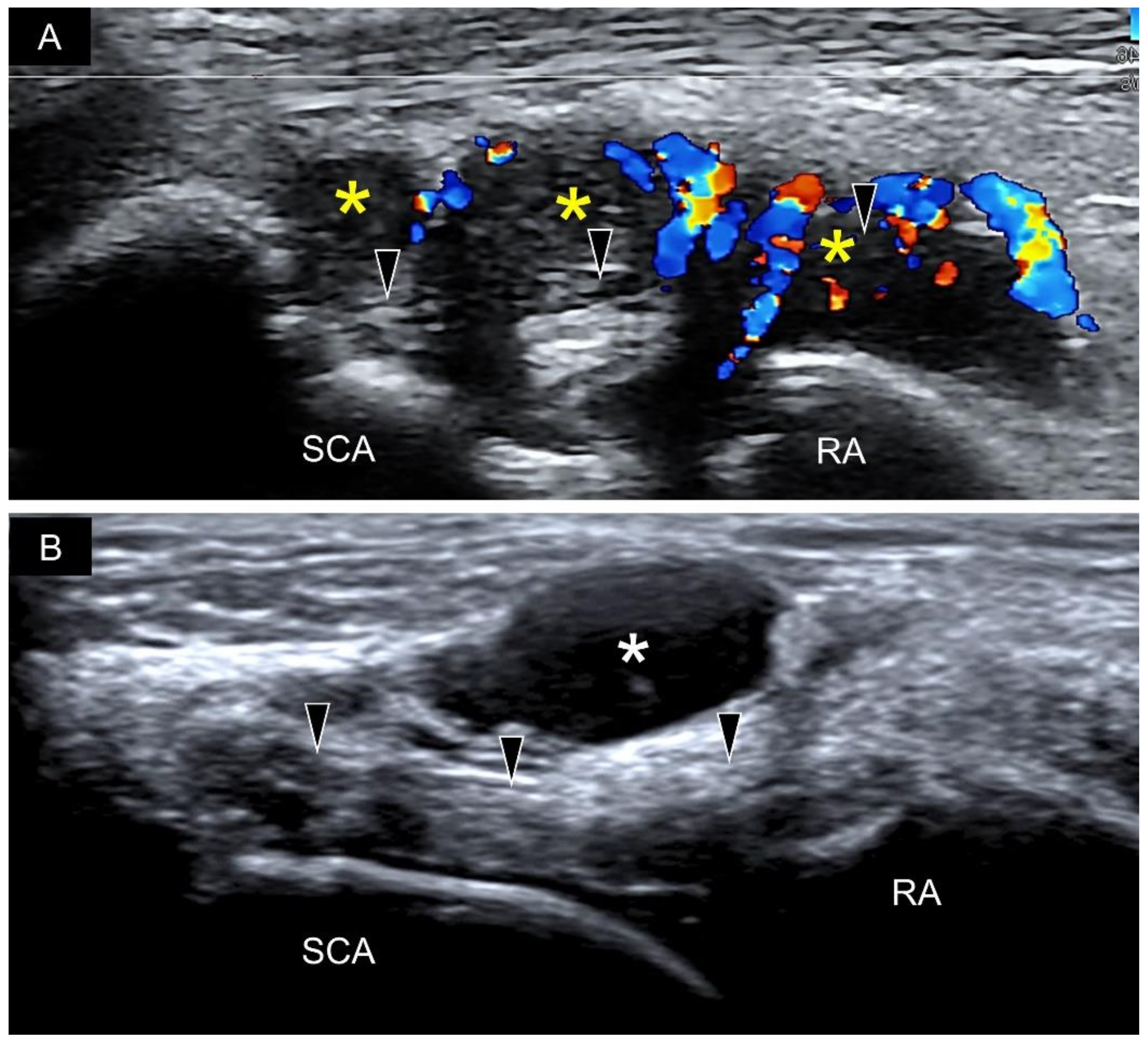 Diagnostics 11 01834 g020 550