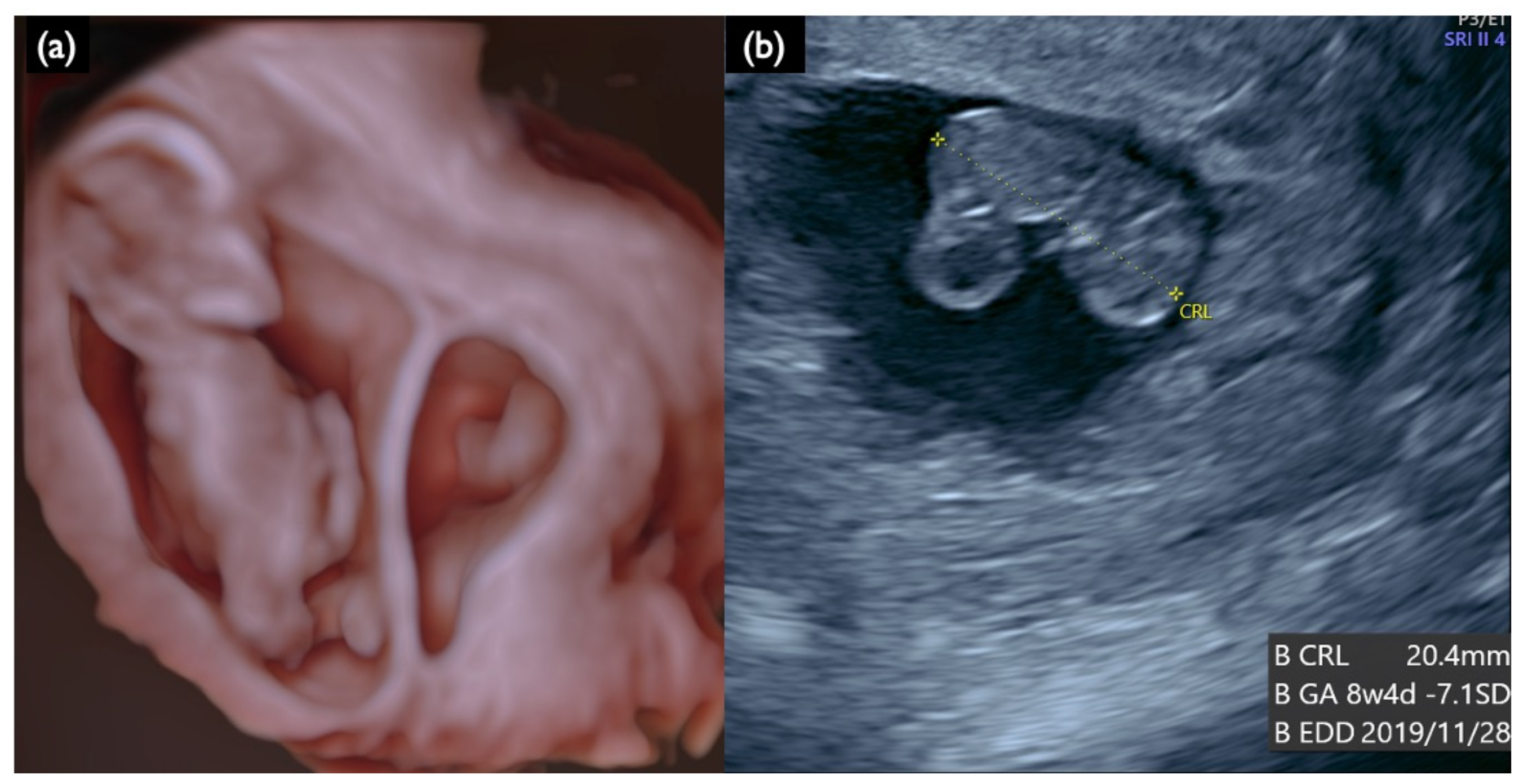 Diagnostics 11 01837 g005 Diagnostics 11 01837 g005