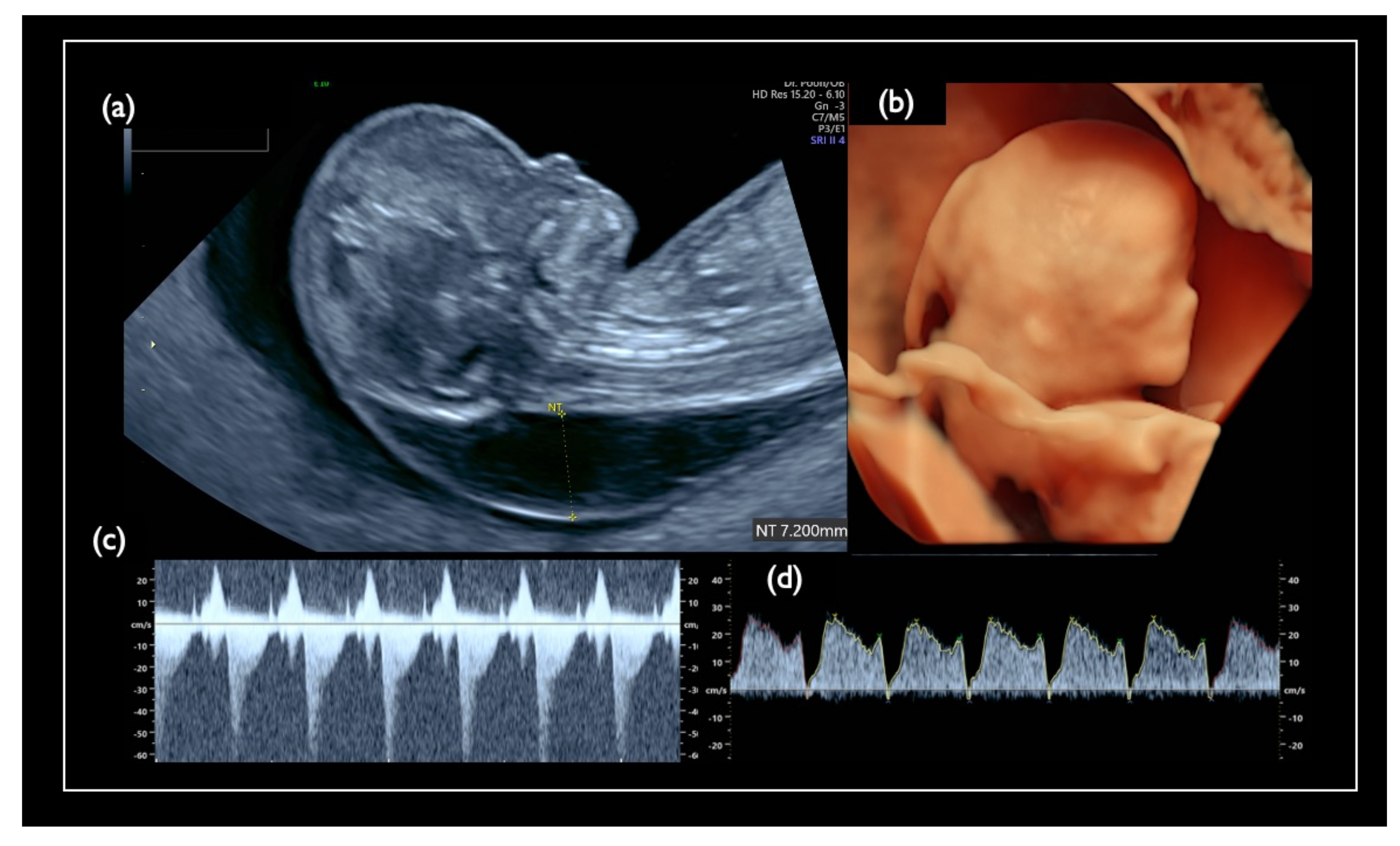 Diagnostics 11 01837 g007 Diagnostics 11 01837 g007