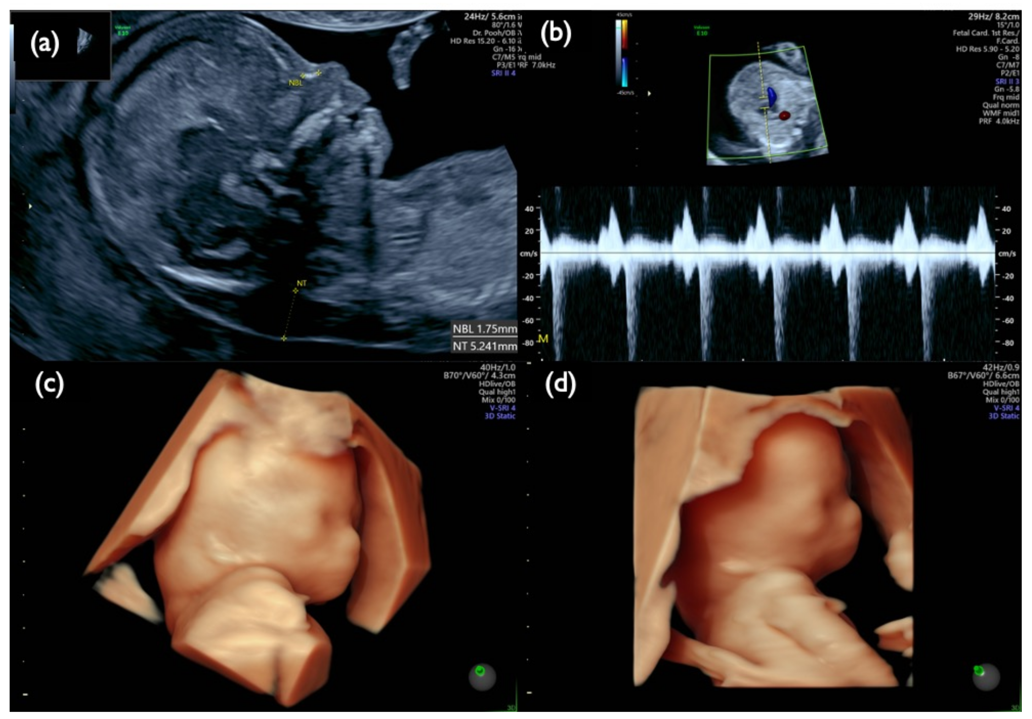 Diagnostics 11 01837 g009 Diagnostics 11 01837 g009