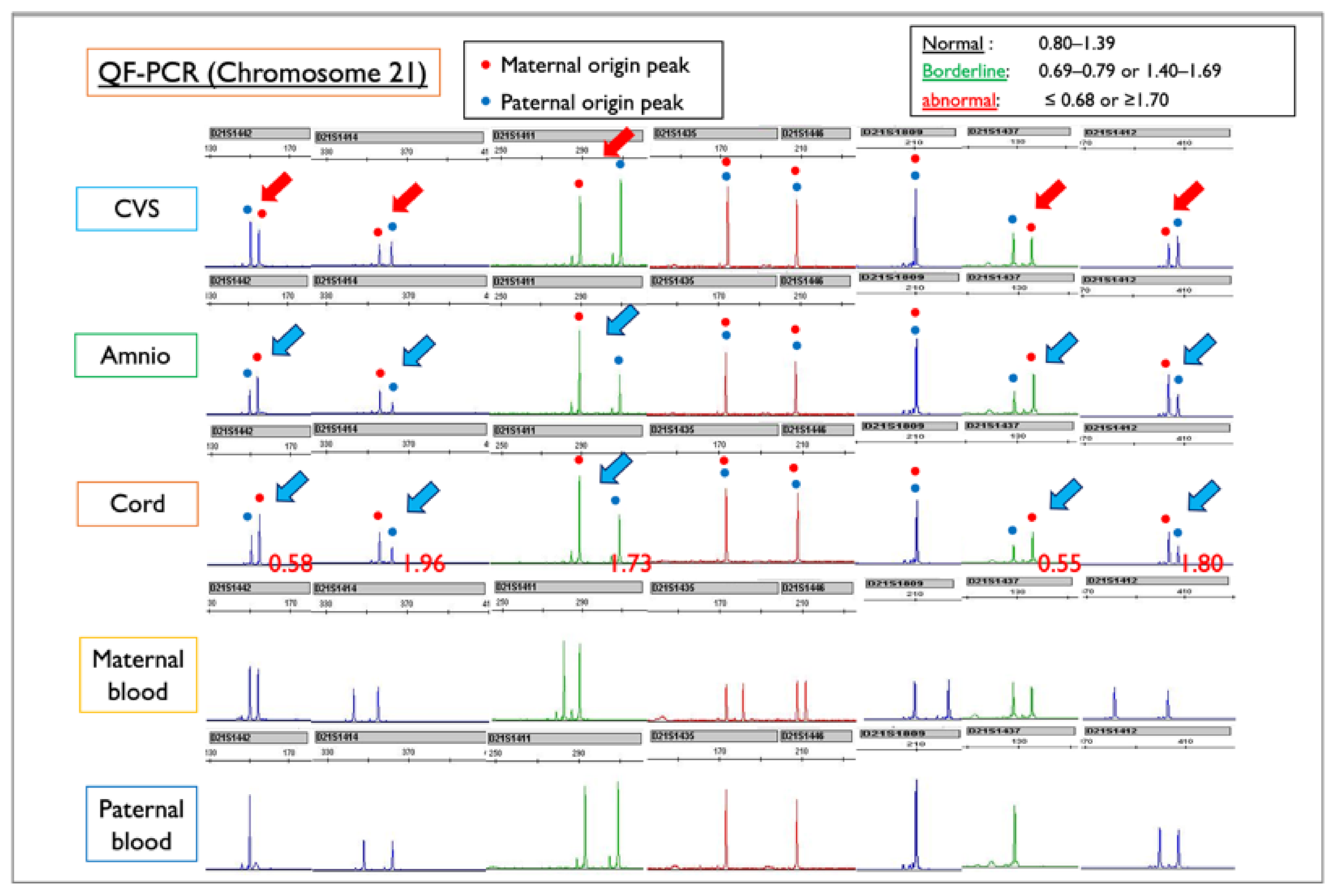 Diagnostics 11 01837 g010 Diagnostics 11 01837 g010