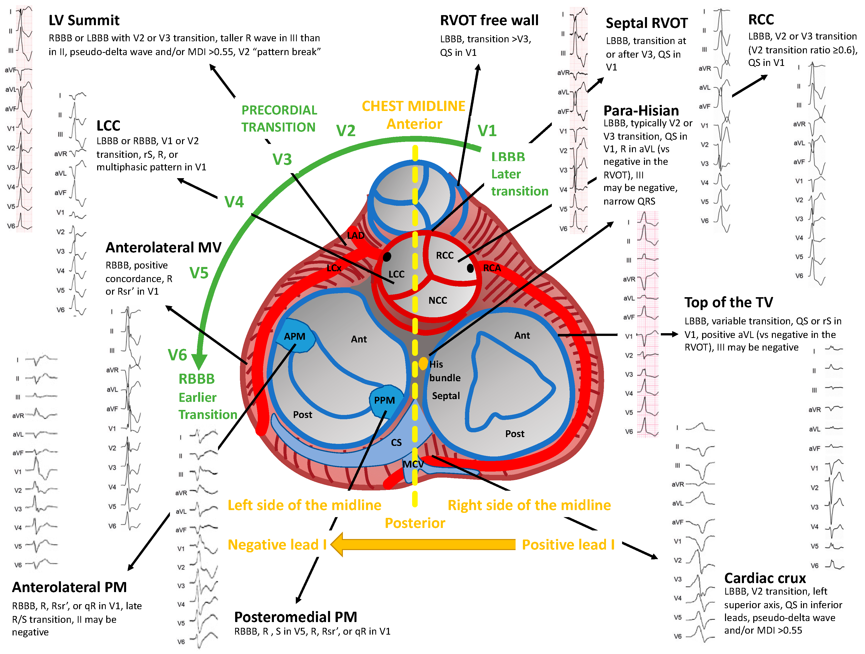 Navigating the Hurdles in Heart Attack Testing: The Key to Preventing Sudden Death - Cardio Diagnostics