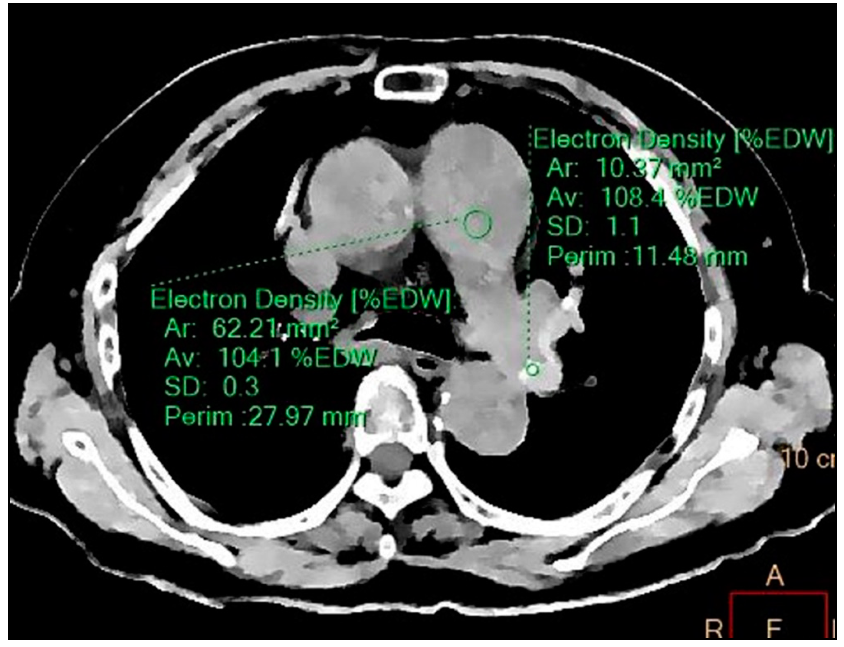 Diagnostics 11 01841 g004