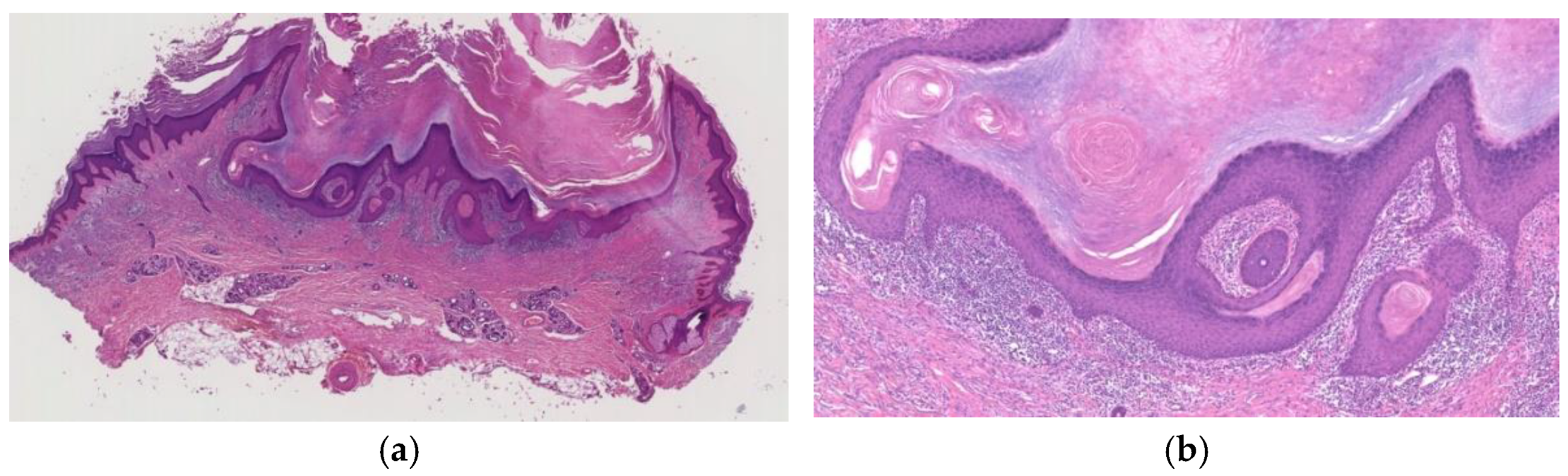 Diagnostics 11 01848 g005 550