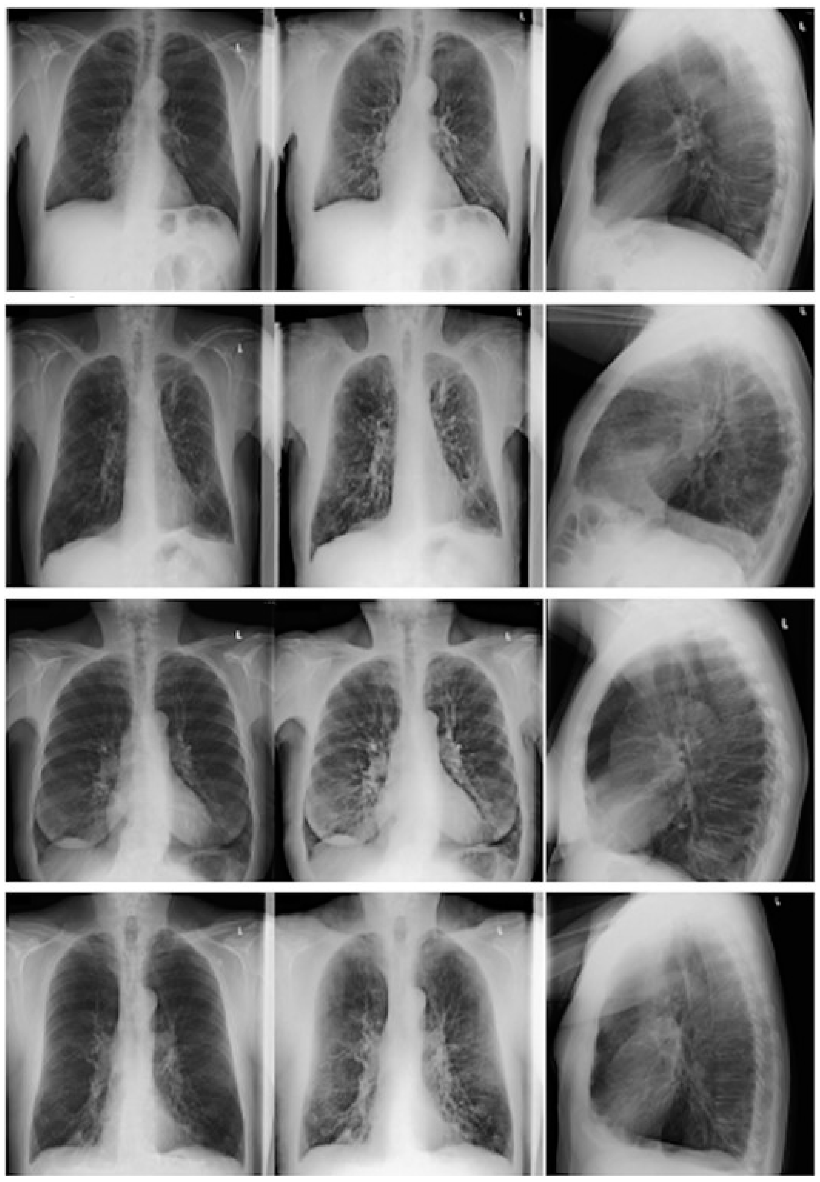 Diagnostics 11 01849 g003 Diagnostics 11 01849 g003