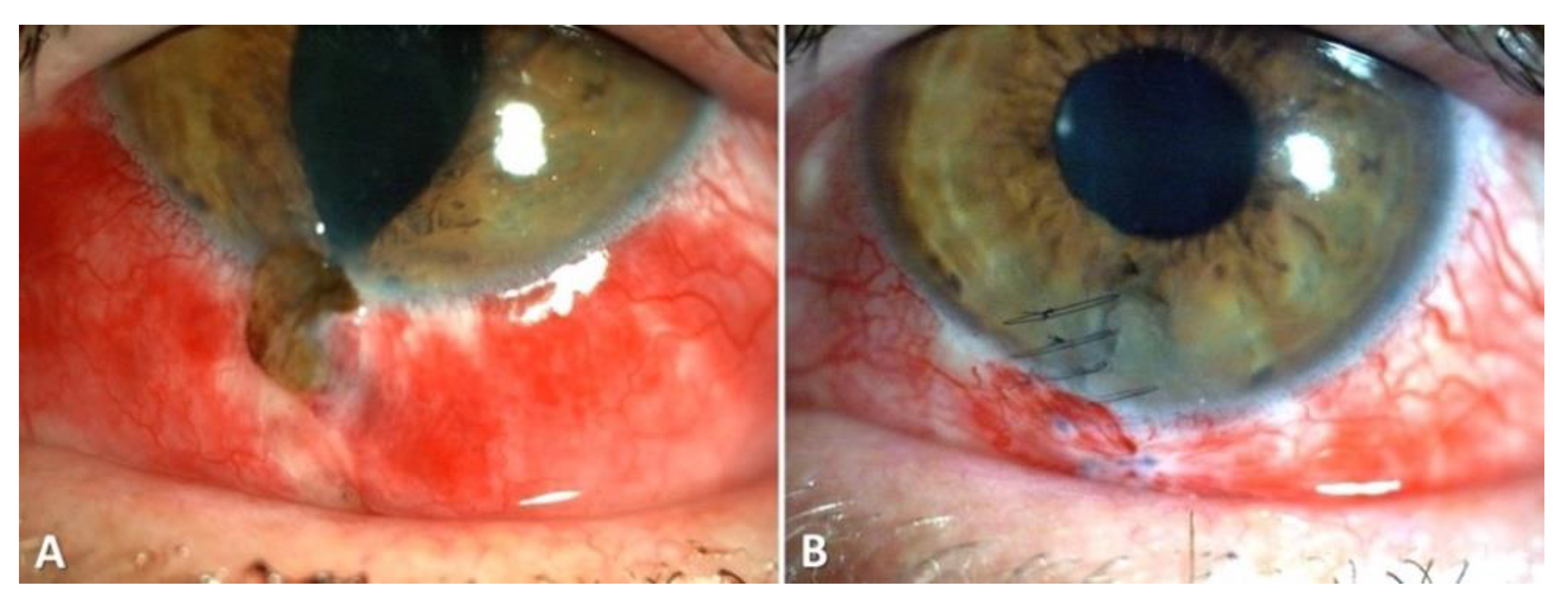 Diagnostics 11 01851 g002 550