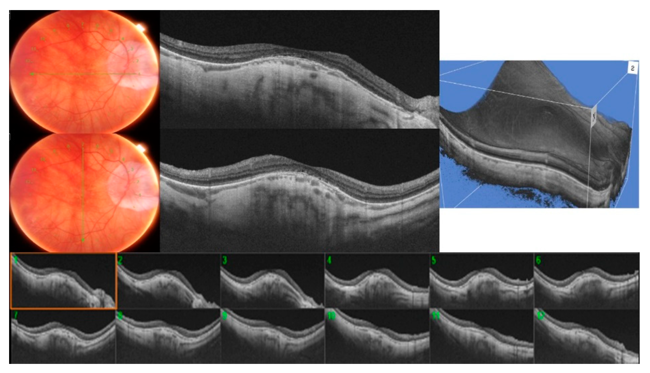 Diagnostics 11 01864 g002 550