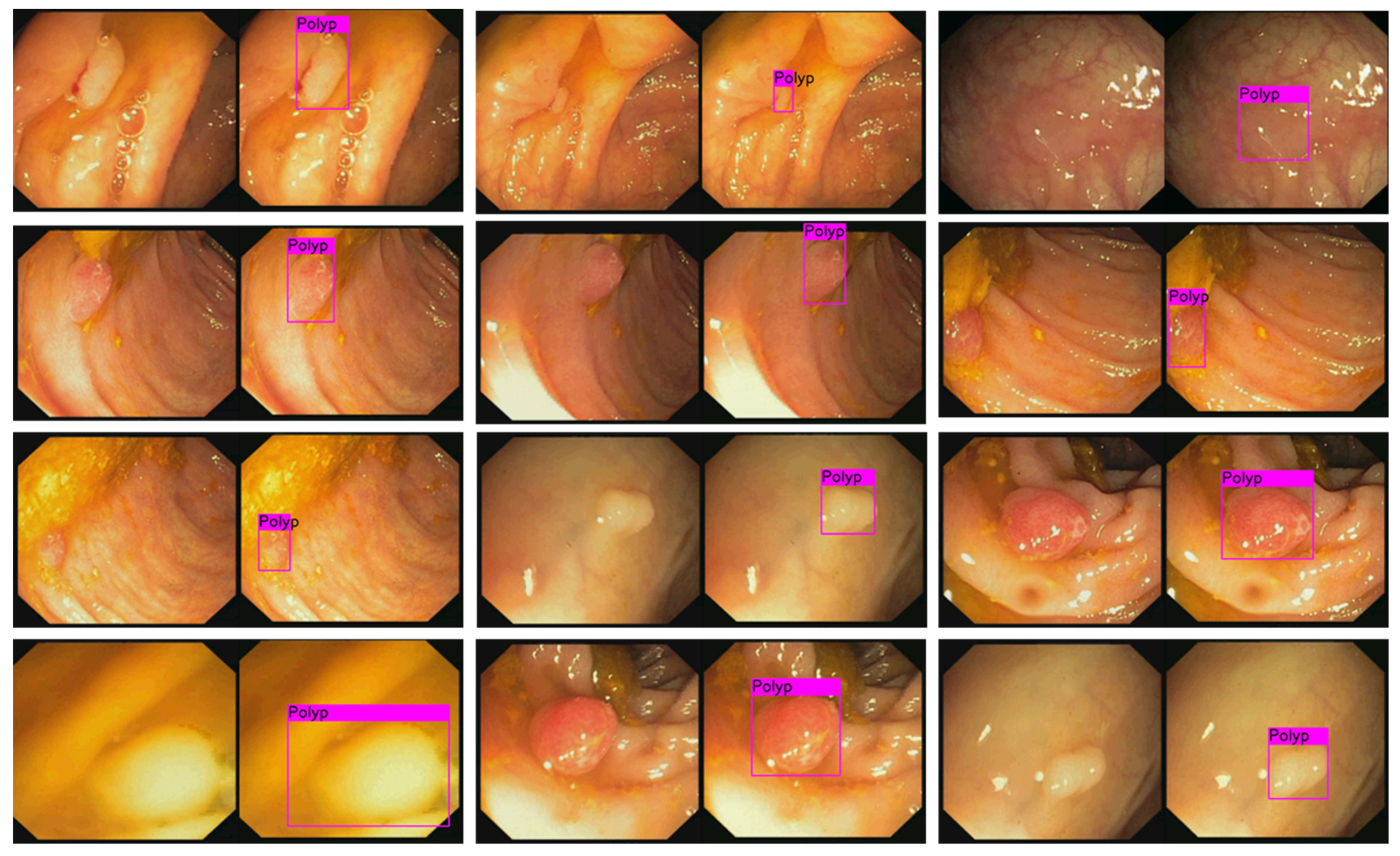 Diagnostics 11 01878 g011 550