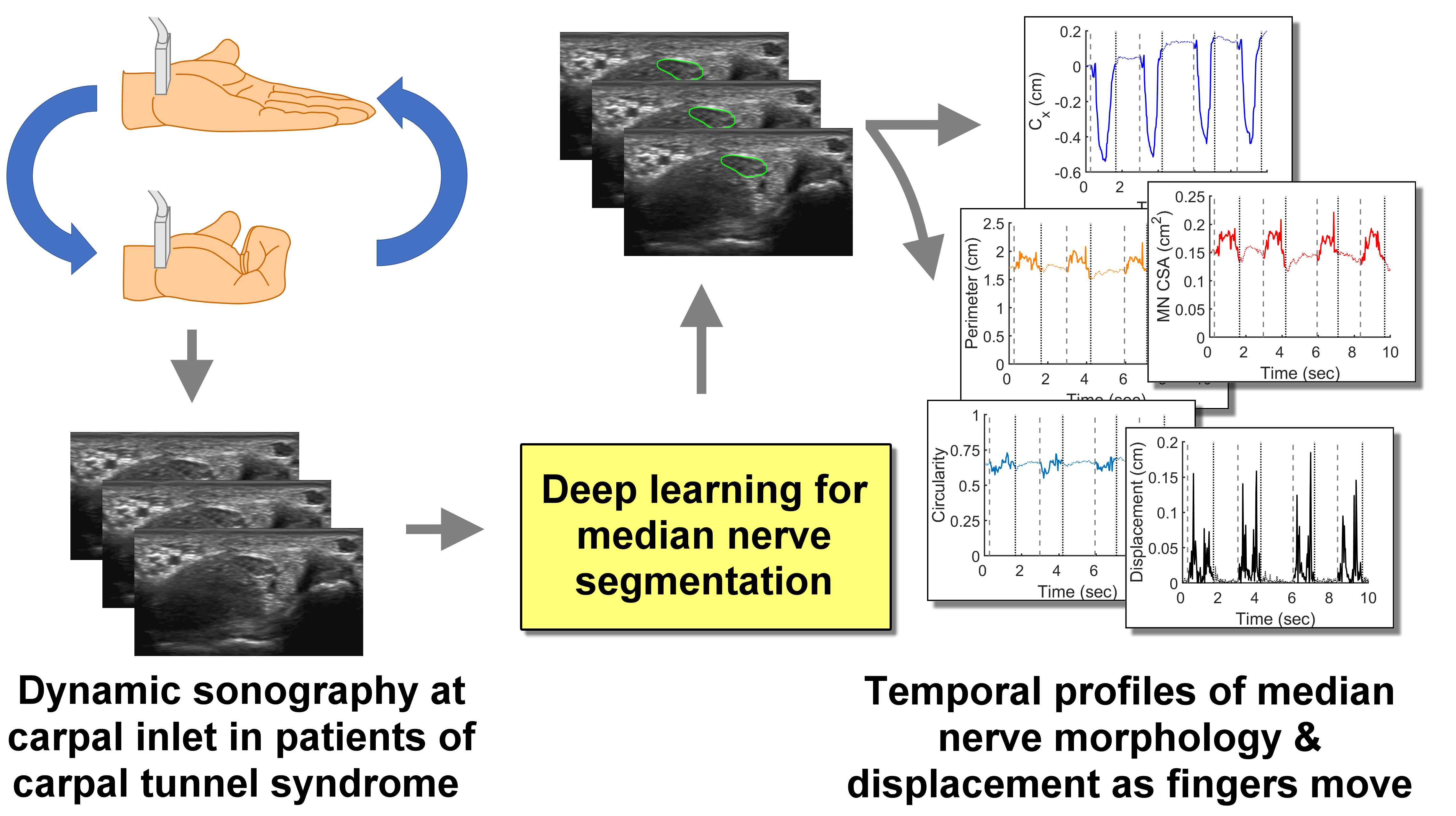 Diagnostics Free FullText Automated Segmentation of Median Nerve