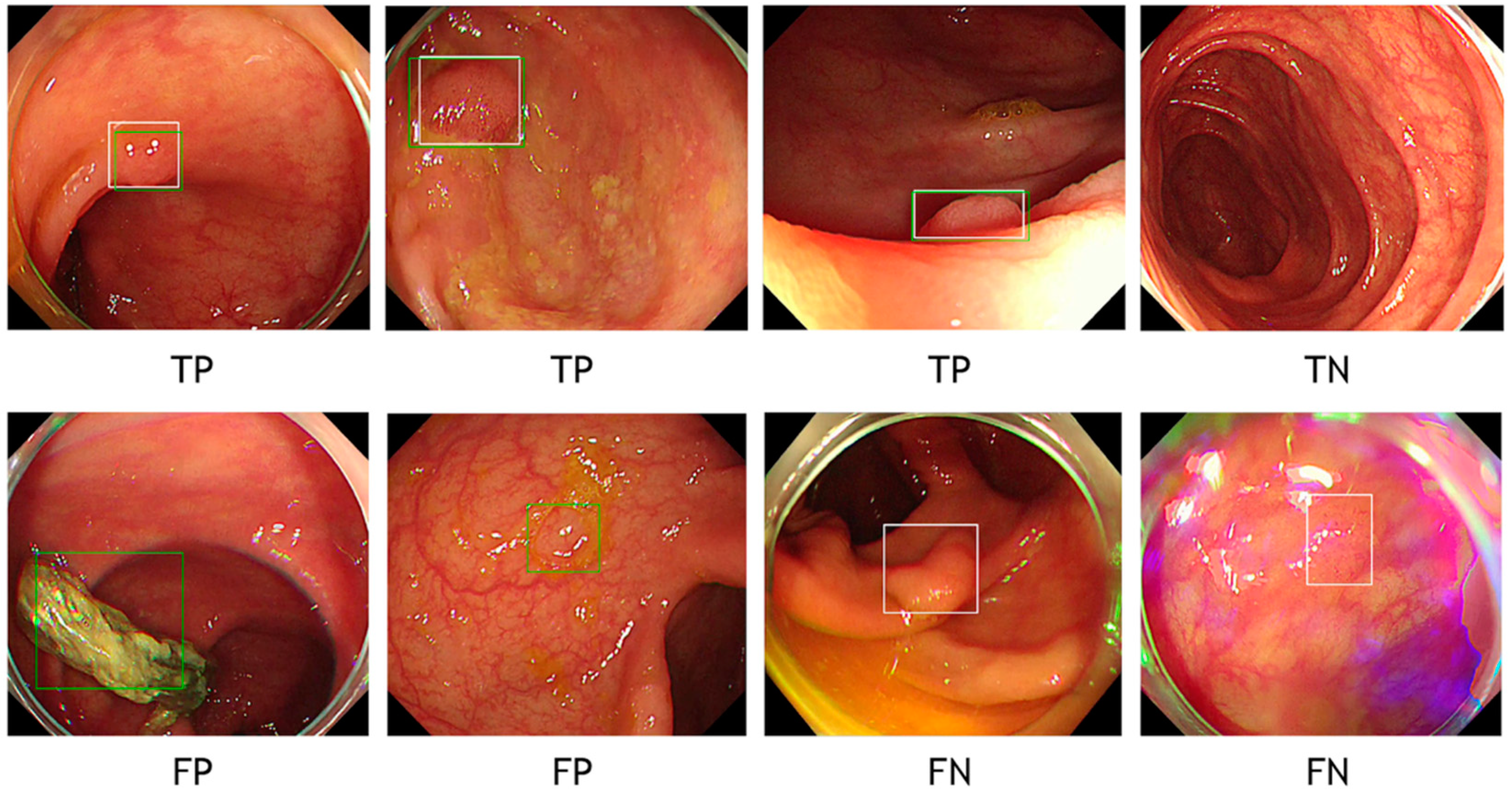 Diagnostics 11 01922 g002 550