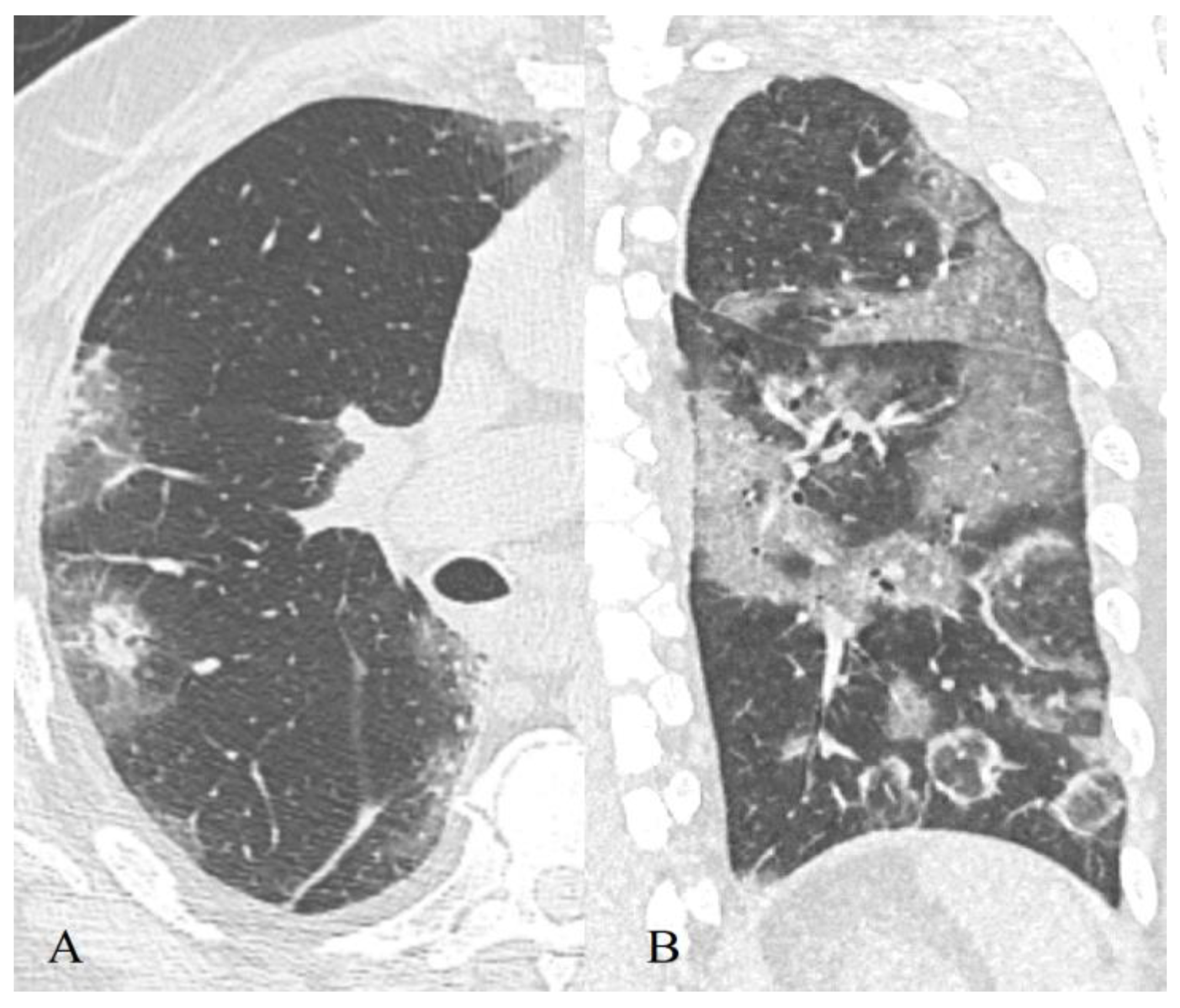 Diagnostics 11 01937 g004